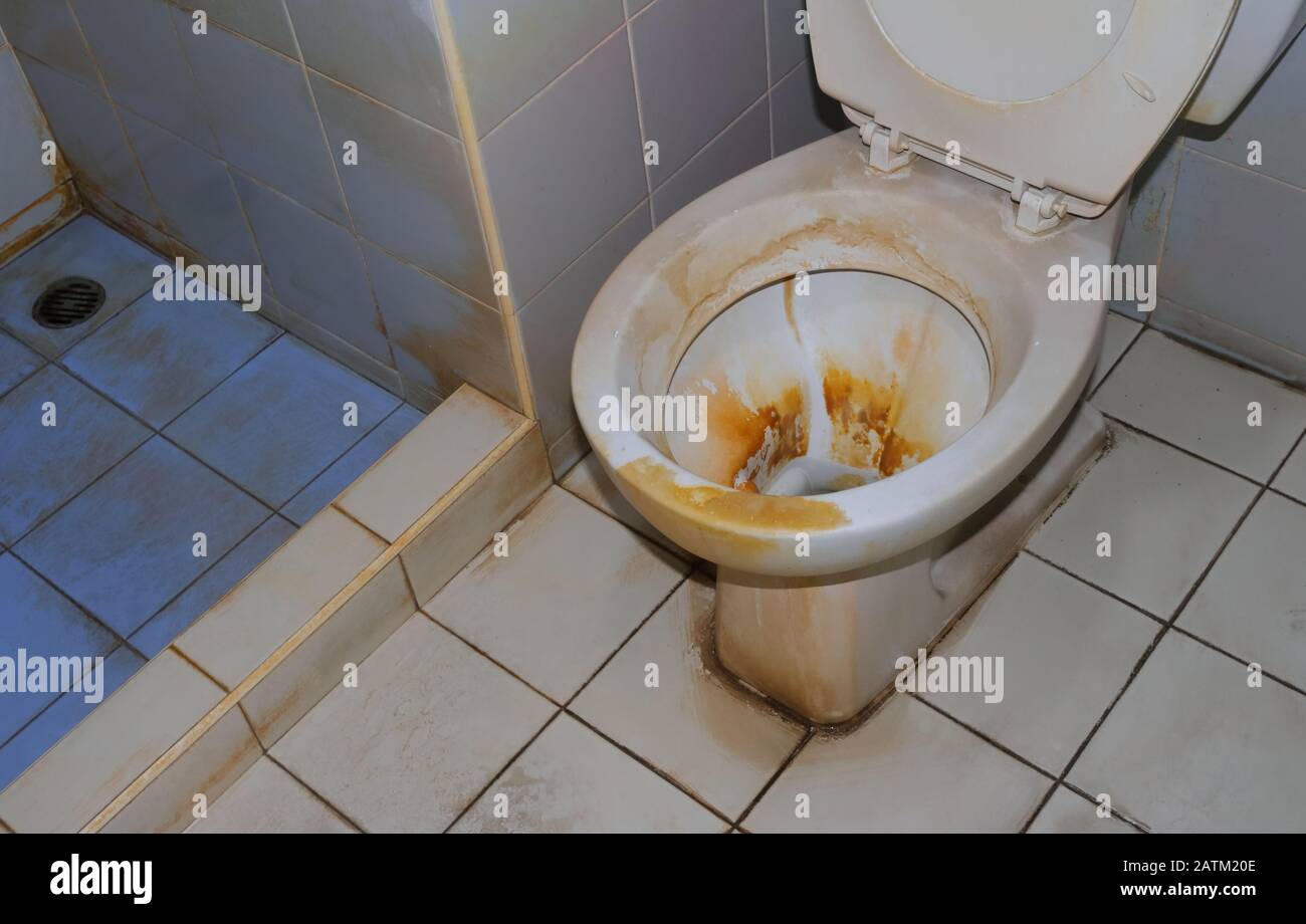 In der Nähe vernachlässigte schmutzige toilettenschüssel mit schweren braunen Flecken, dies kann zu Krankheiten und Hygienekonzept führen Stockfoto