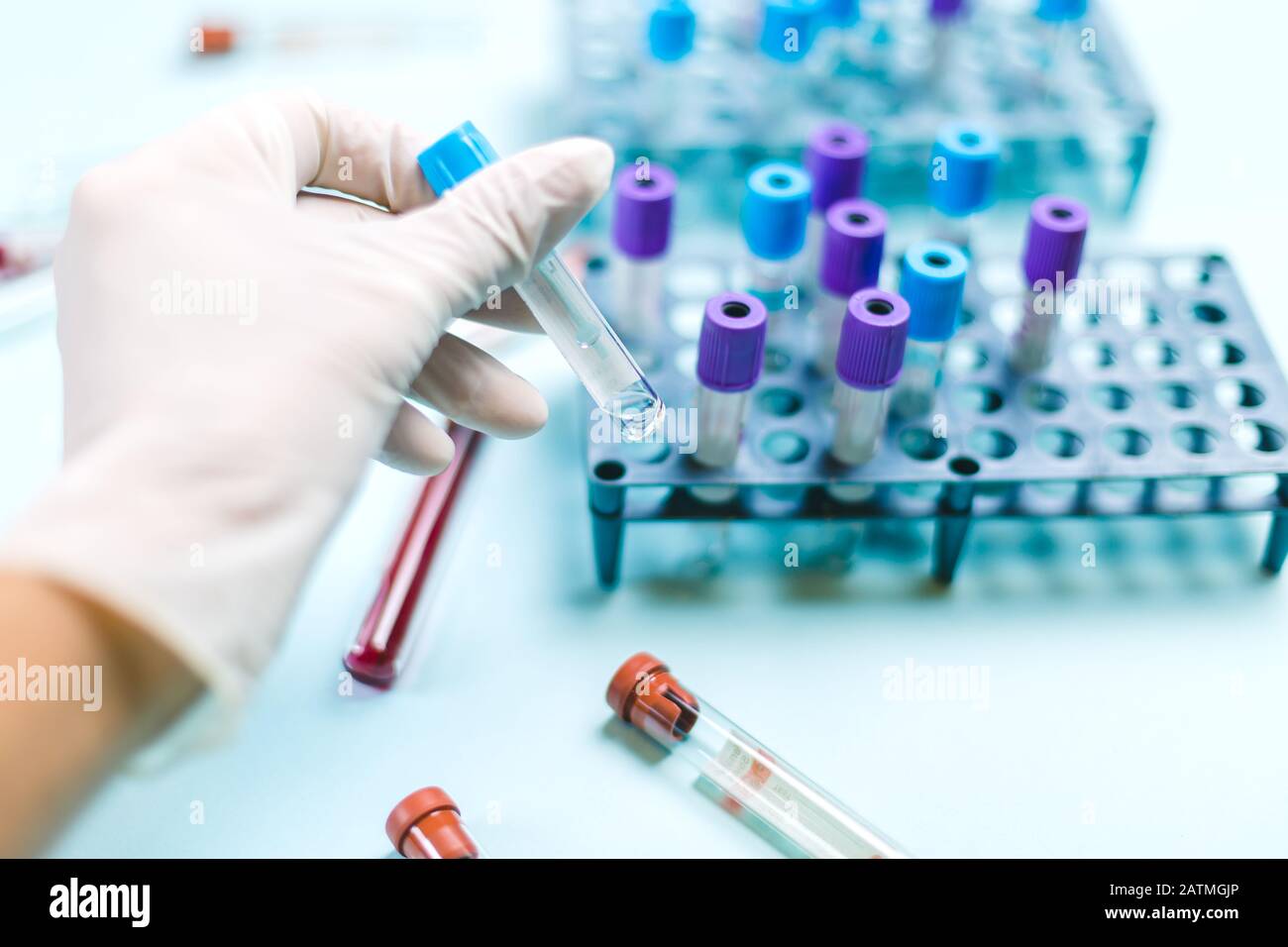 Arzt mit medizinischem Handschuh, der eine Durchstechflasche mit medizinischen Proben im Analyselabor behandelt Stockfoto