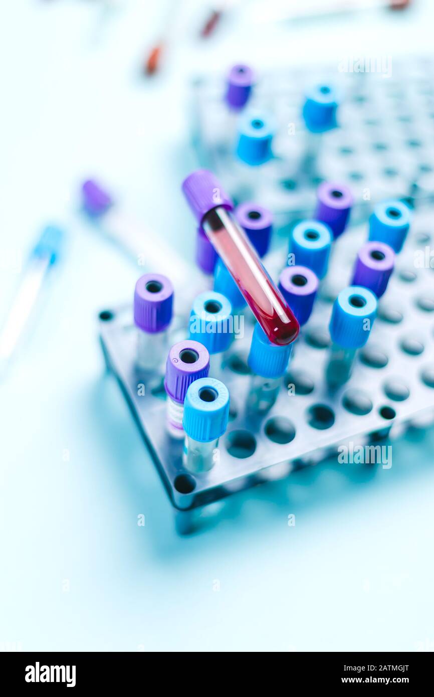Röhrchenfläschchen mit Blutprobe über einem Rechen mit medizinischen Proben im Labor für medizinische Analysen. Platz für Text Stockfoto