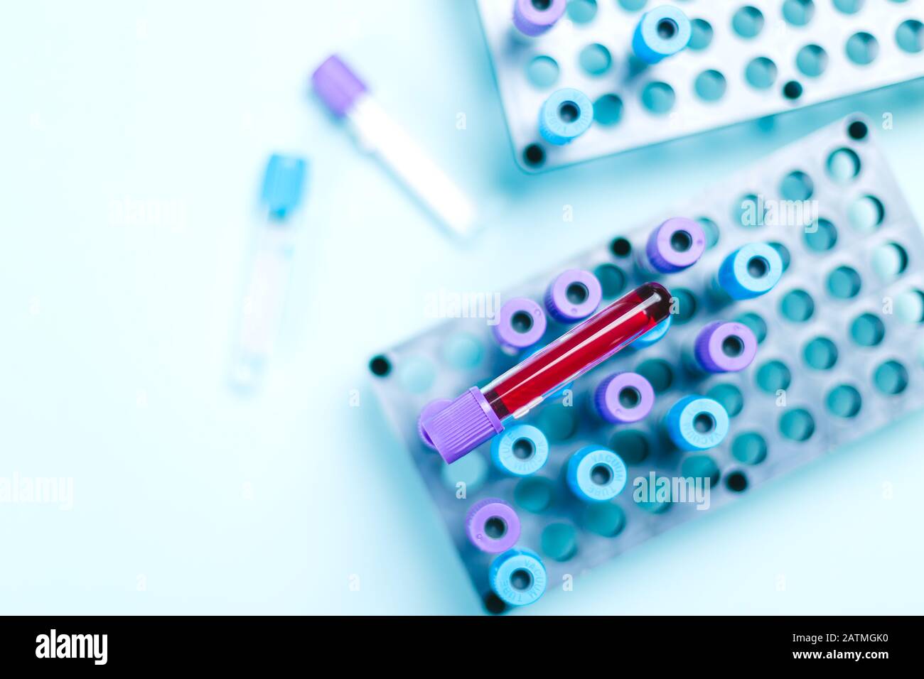 Probenröhrchen mit Blutprobe über einem Rechen mit medizinischen Proben im Labor für medizinische Analysen. Bluttestkonzept mit Platz für Text Stockfoto