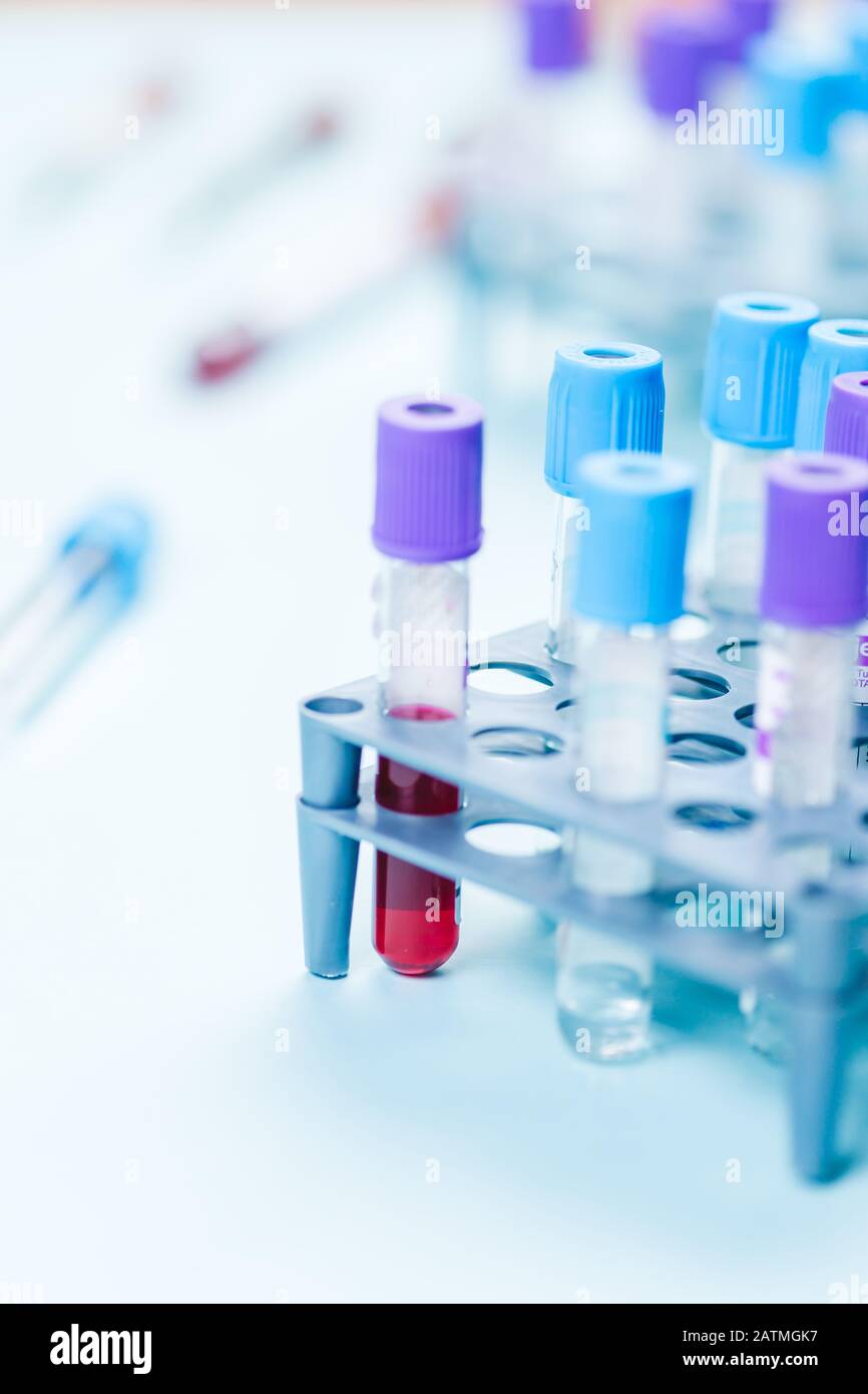 Röhrchenfläschchen mit Blutprobe und medizinischen Proben auf dem Rack im Labor für medizinische Analysen. Platz für Text. Stockfoto