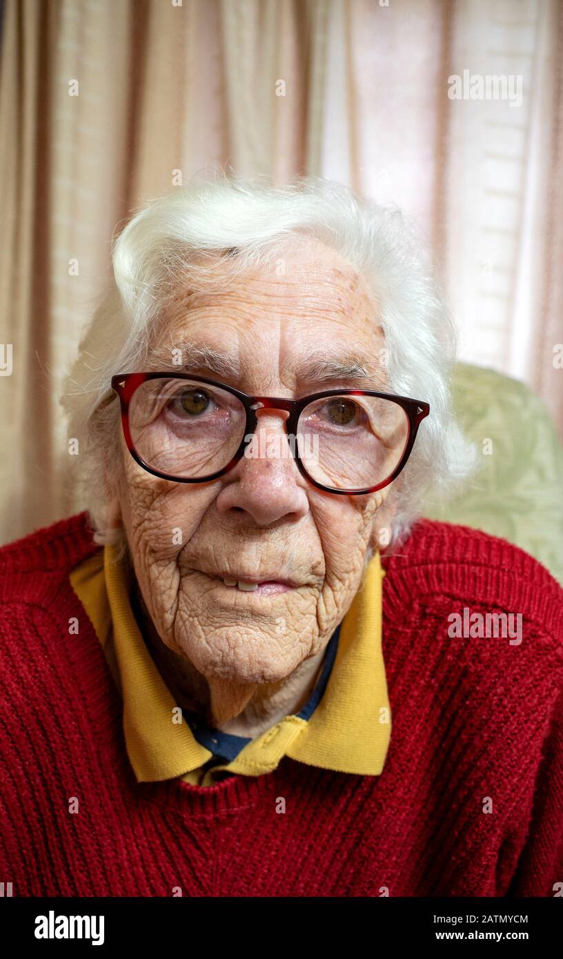 Frau, die an altersbedingter Makuladegeneration leidet Stockfoto
