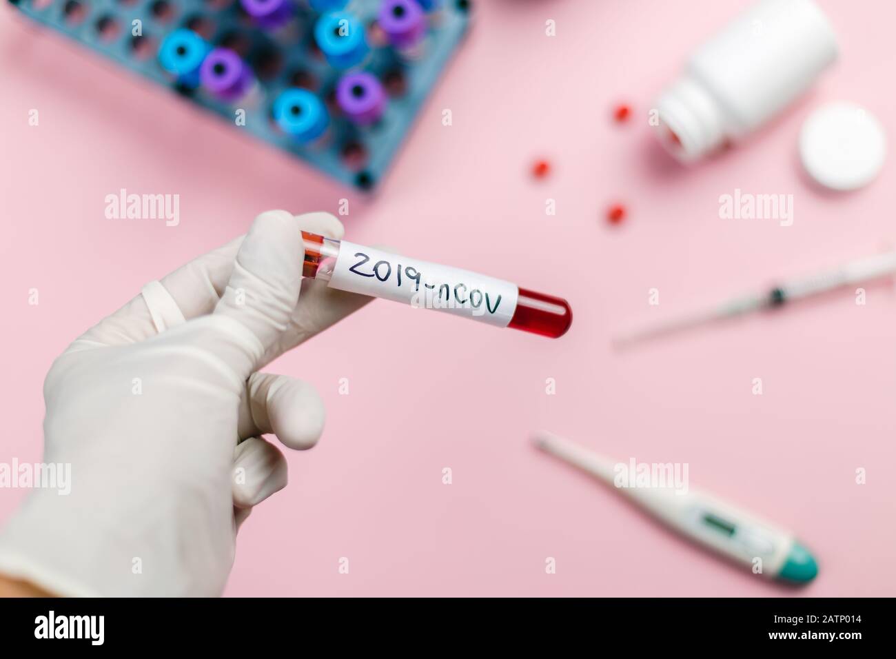 Immunologe, der eine mit Coronavirus verunreinigte Blutröhre hält. Konzept des pandemischen Coronavirus. Stockfoto