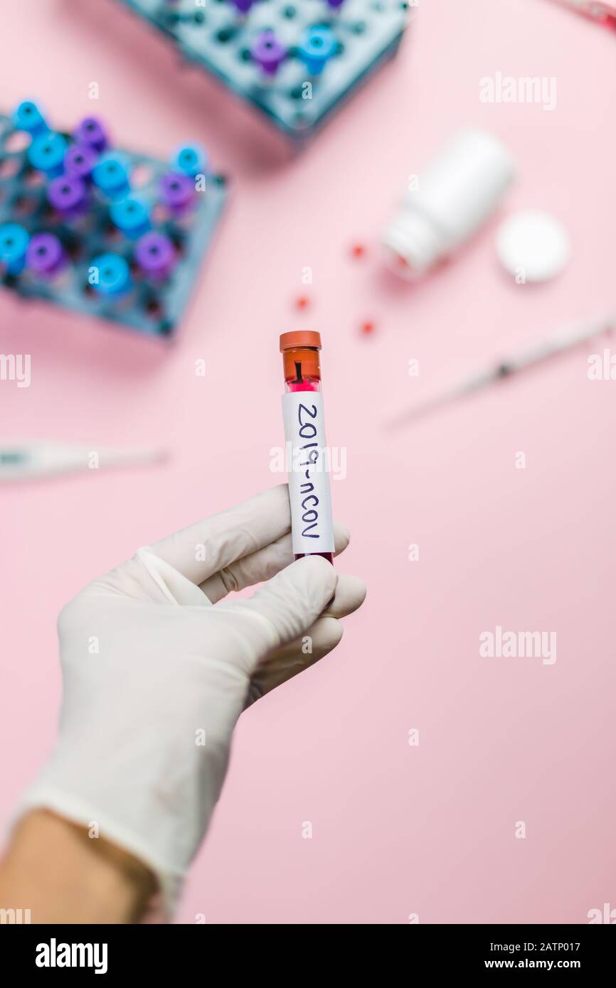 Imunolog mit Coronavirus, 2019-nCOV-Virus, hält eine Kontamination des Blutrohrs. Platz für Text. Stockfoto