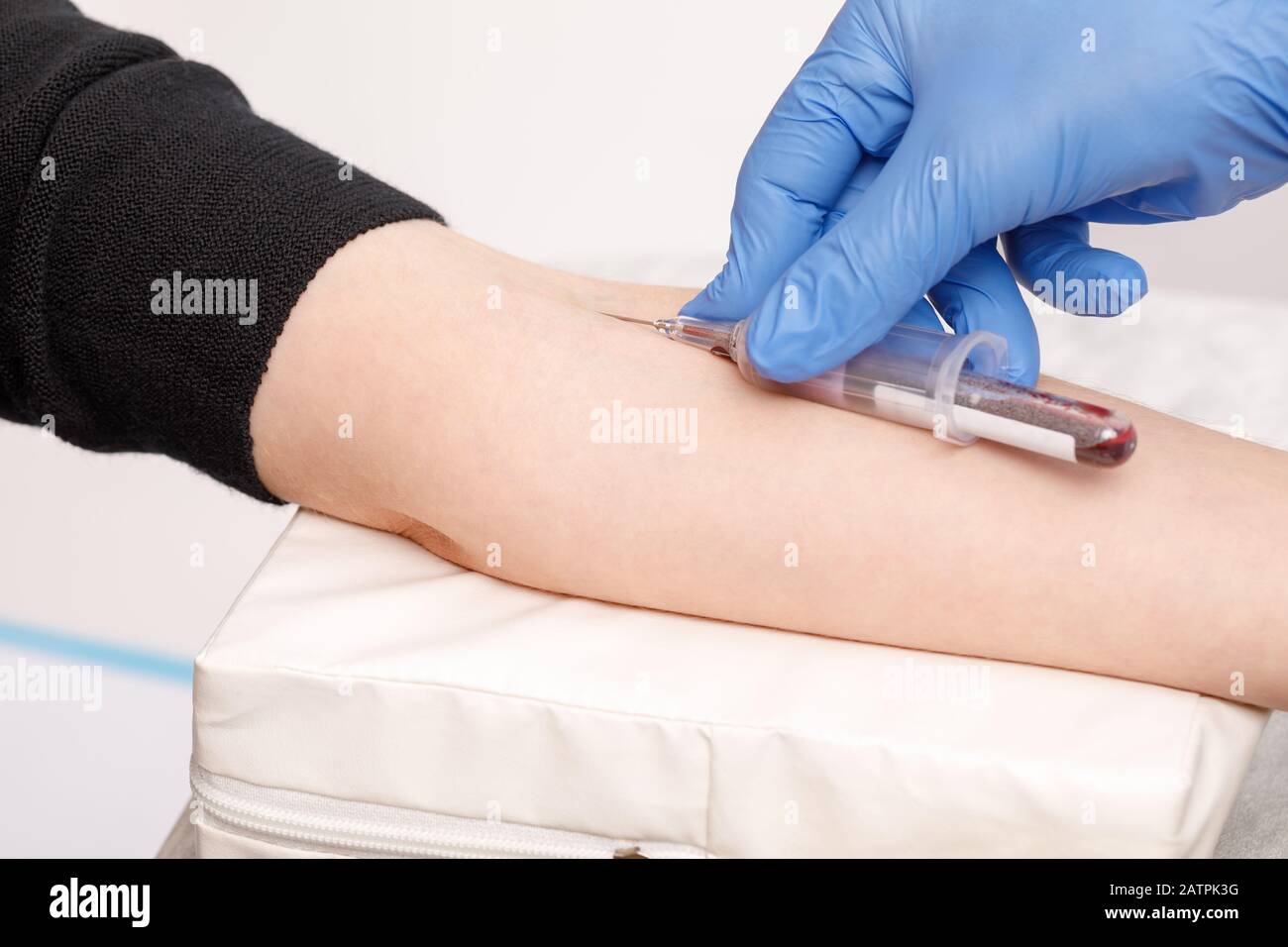 Nahaufnahme des Arztes oder der Krankenschwester, die Blut aus der Armvene eines Patienten mit einem Staubsauger sammelt. Venenpunktion oder Venenpunktion Stockfoto