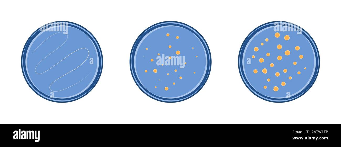 Mikrobiologie. Kolonie Bakterien Wachstum in petry Dish, 3 Stufen, Vektor-Flat-Stil. Stock Vektor