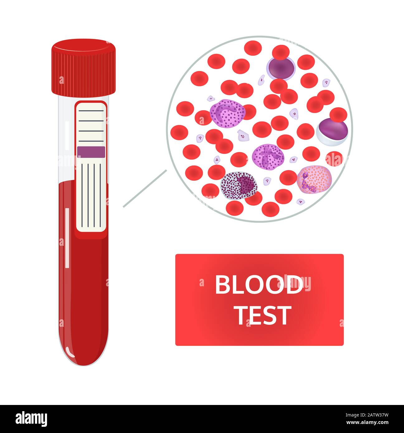 Medizinisches Vektorkonzept. Blutanalyse in Reagenzgläsern und Blutzusammensetzung unter dem Mikroskop. Rote und weiße Blutkörperchen, Thrombozyten Bild. Stock Vektor