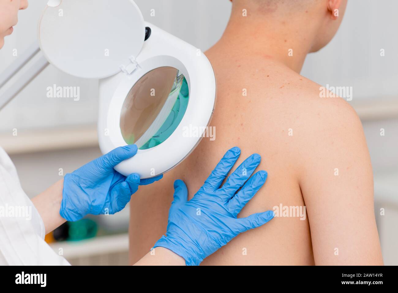 Ein Dermatologe untersucht die Haut am Körper eines jungen Mannes durch eine Lupe einer Kosmetologie-Lampe. Schönheitsbehandlungen Stockfoto