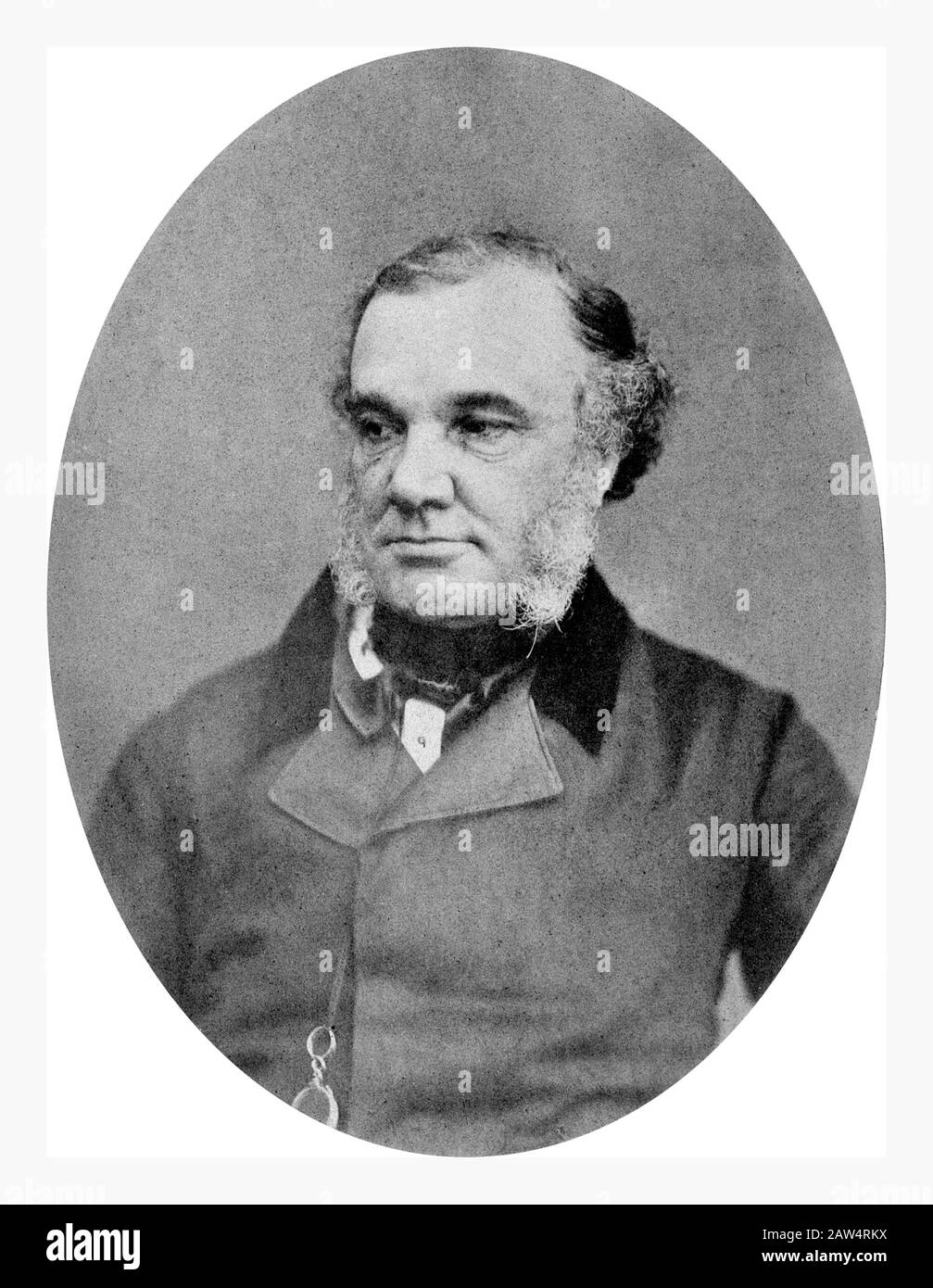 1850 Ca, GROSSBRITANNIEN: Der brite Thomas Addison (* zwischen 1790-1860), renommierter Großarzt und Wissenschaftler am Guy's Hospital in London. Foto vorbei Stockfoto