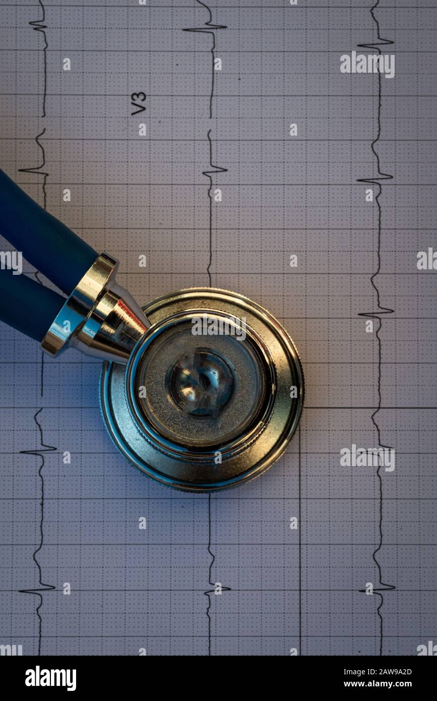 Stethoskop auf Elektrokardiograph.,Herzpflege,Wohlbefinden. Hintergrund. Stockfoto