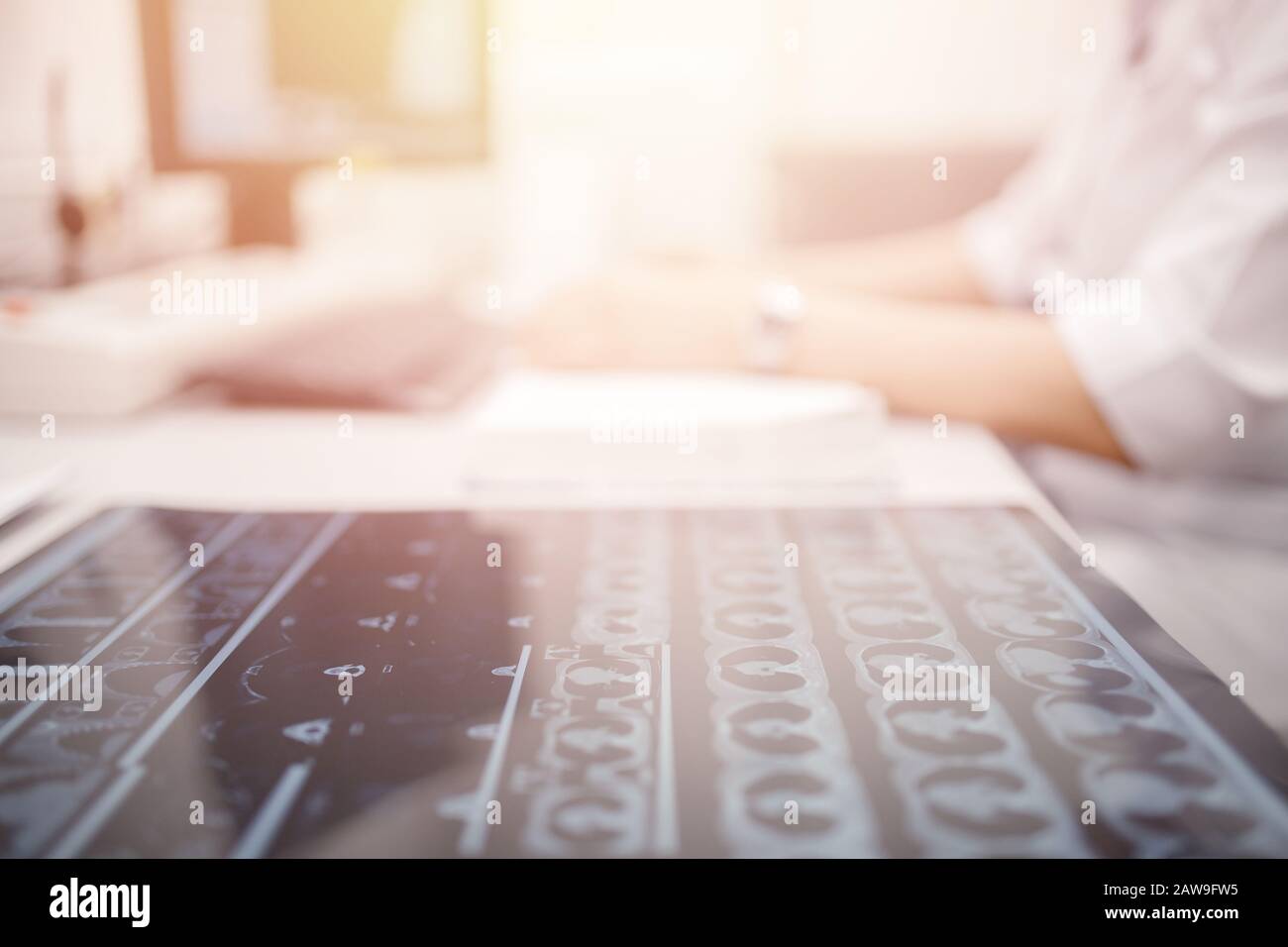 Magnetresonanztomographie. Nahaufnahme MRT-Scan ergibt Krebsarzt. Stockfoto
