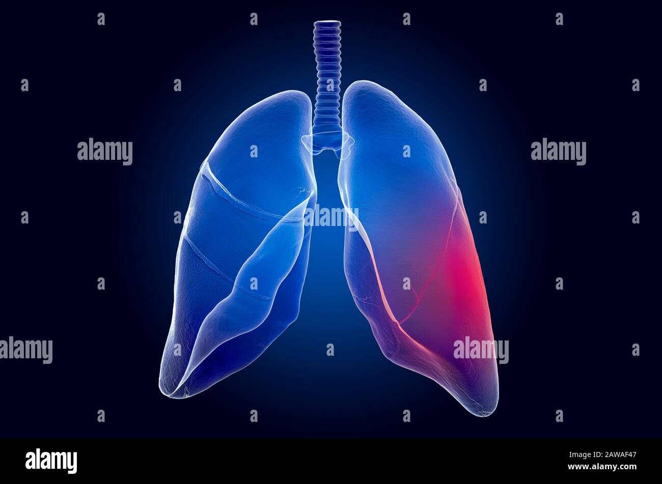 Konzept der Schmerzen in Der Lunge. Ghost Light Effect, Röntgenhologramm. 3D-Rendering auf dunkelblauem Hintergrund Stockfoto