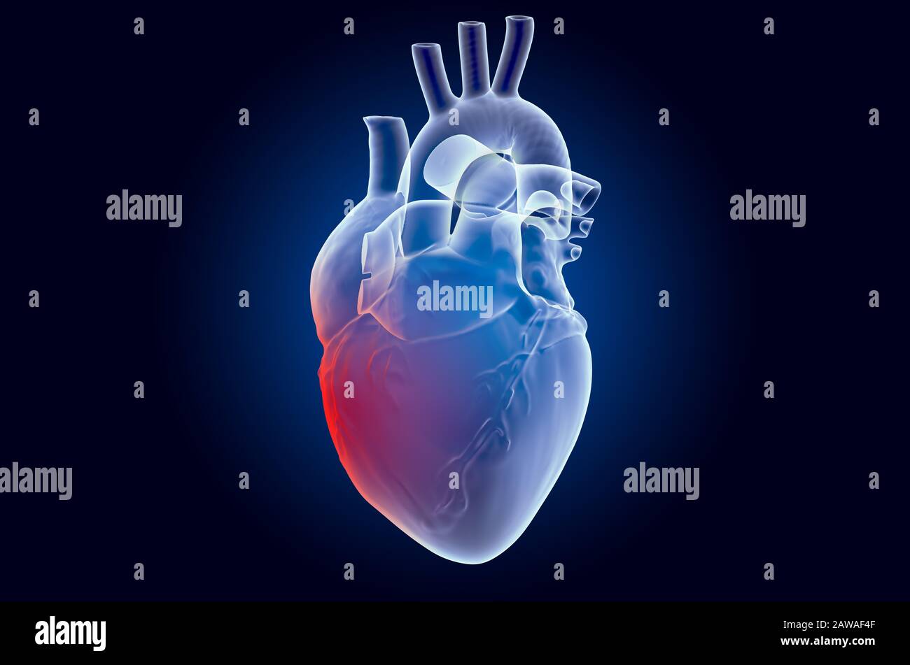 Konzept "Schmerzen im Herzen". Ghost Light Effect, Röntgenhologramm. 3D-Rendering auf dunkelblauem Hintergrund Stockfoto