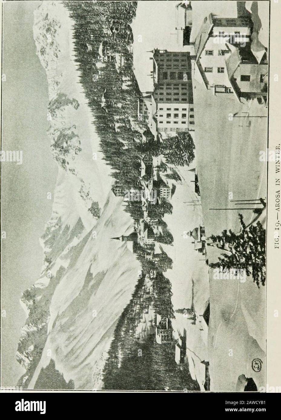 Tuberkulose im Säuglingsalter und Kindesalter: Ihre Pathologie, Prävention und Behandlung. ABB. IB.-DAVOS IX WINTER. Alpine Gesundheitsstationen. Von den Hochalpenresorts sind Davos, St. Moritz und Arosa am bekanntesten und am vollsten ausgestattet. Weitere Hochstapler sind Leysin (4.757 Fuß über dem Meeresspiegel), Chateau dOex (3.261 Fuß), Grindelwald (3.468 Fuß), Les Avants (3.232 Fuß), Caux (3.690 Fuß), Montana (4.960 Fuß) und Adelboden (4.450 Fuß). In Zuoz (5.660 Fuß), im Oberengadin, befindet sich eine internationale Schule. Jedes Platzhalterzeichen hat seine eigenen charakteristischen Merkmale, wodurch es mehr Freiraum erhält Stockfoto