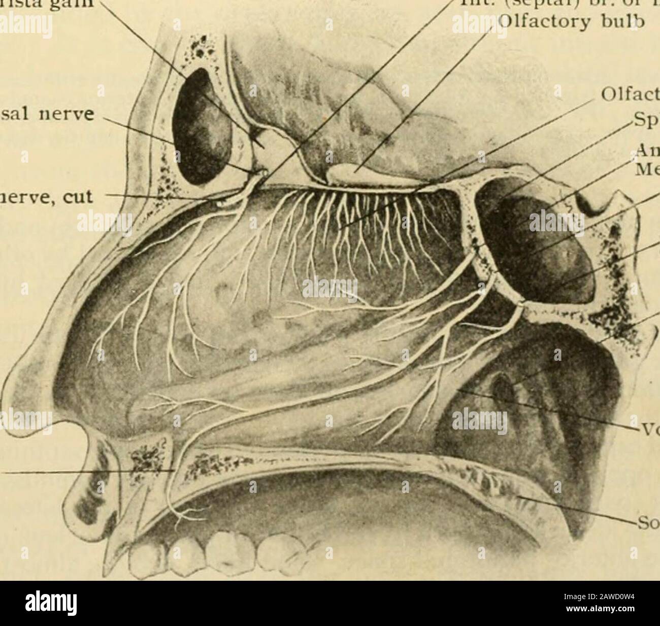 Anatomie des Menschen, einschließlich Struktur und Entwicklung und praktische Überlegungen. Nervenfasern Olfaktorisch Ein oberes Nasal br.meckels ganKlion Ipper jx)ST. Nasal brs.Meckel Ganglion Naso-Palatine Nerv (Supant. Nasale br. Ofs Meckel ^anKl. ANT. Nasale br. Descendingpalatine nerveA i)osterior nasale Gangel, Angant absteigend. Die mittlere Palatine, die posteriorly Rechts nasale Fossa zeigt, die Verteilung der olfaktorischen und nasalen Nerven auf der Seitenwand; die Schleimhaut wurde teilweise entfernt, um die Nerven freizulegen, deren Fasern nicht medultiert sind, weisen einen Klammerschlag auf. Stockfoto