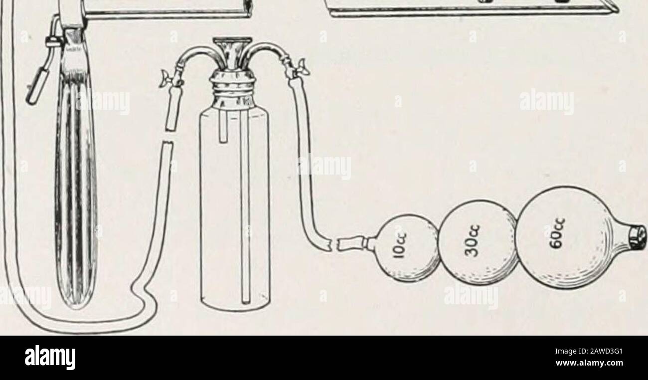 Perorale Endoskopie und Kehlkopfchirurgie . Abb. I6. Autoren lircmchoscope wie ursprünglich geplant. Der Autor hat sich zu dieser kleinen, von T. Drysdale Buchanan vorgeschlagenen Ranch-Röhre hadadiert. (Abb. 17). Der abgeschrägte Tulpenmund gibt eine Lippe, die nicht nur die Einführung erleichtert, sondern auch die vielfältigen Verwendungsmöglichkeiten von Buthas. Alle Autorenröhrchen sind mit Kaltlampen ausgestattet, die in einer Aussparung aus Schäden und aus der Sichtlinie heraus liegen. Spirierende Canalsare wurden gelegentlich nützlich gefunden, bevor der Autor seine Schwammpumpfmethode zur Entfernung von Sekreten entwickelte. R^. Abb. 17. Dosimetrische Anästhesieausrüstung für den B. Stockfoto