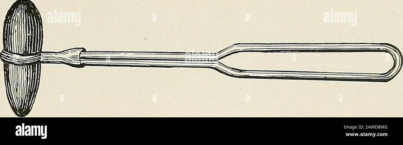 Erkrankungen des Brustkorbs und die Prinzipien der körperlichen Diagnose . ercussiert, je genauer die topografischen Ergebnisse sind (siehe Abb. 75). Der halbe Durchmesser des Pleximeters muss immer als unvermeidbarer Fehlerrand bei der Abschätzung der Grenzen zwischen anairhaltiger und einer luftlosen Struktur als Herz und Lunge zugelassen werden, auch wenn das Pleximeter in einer Richtung parallel zur erwarteten gebundenen Linie aufgetragen wird. Auf der Grundlage dieser Fakten wurden einige sehr enge, keilförmige Pleximeter (Ziemmsen) entwickelt, um die Lungenapices, Kardiakgrenzen usw. Zu begrenzen Stockfoto