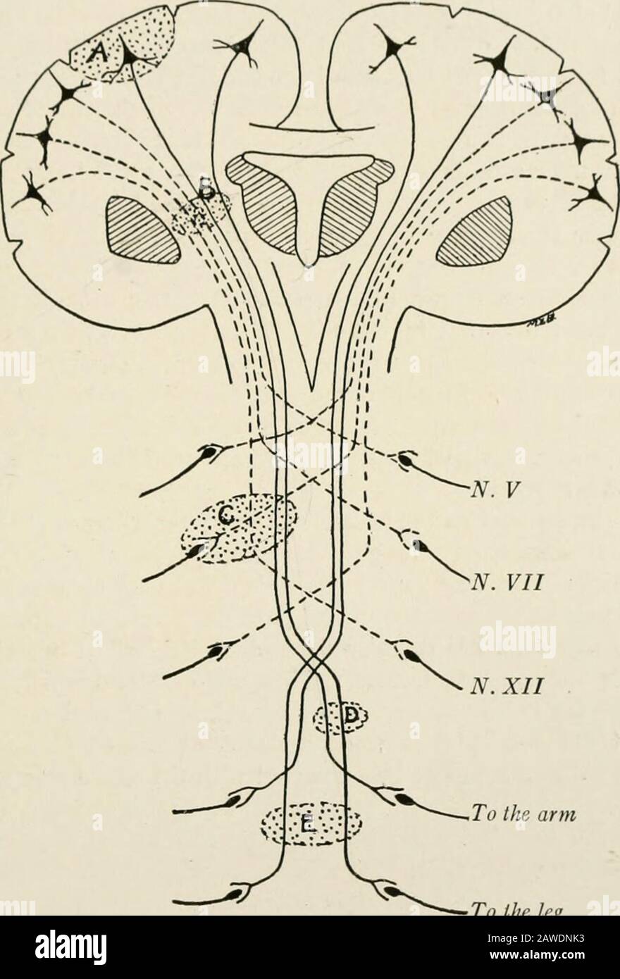 Die Anatomie des Nervensystems aus Sicht der Entwicklung und Funktion . differentielle Charakteriszas diese können erkennen, welche der beiden Glieder in der Motorkette durchbrochen sind. Um die Kombination von Symptomen zu verstehen, die auf verschiedenen Ebenen zu einer Schädigungen des Motorweges führen, ist die Thetopographie seiner Bestandteile zu berücksichtigen. Einige dieser Beziehungen sind in Abb. 241. Da sich der Motorrinde über eine ziemlich weitläufige Fläche verteilt, wird er normalerweise nicht vollständig durch Verletzungen oder Krankheiten zerstört. Ein eingeschränkter kortikaler EFFERENTER PFAD Stockfoto