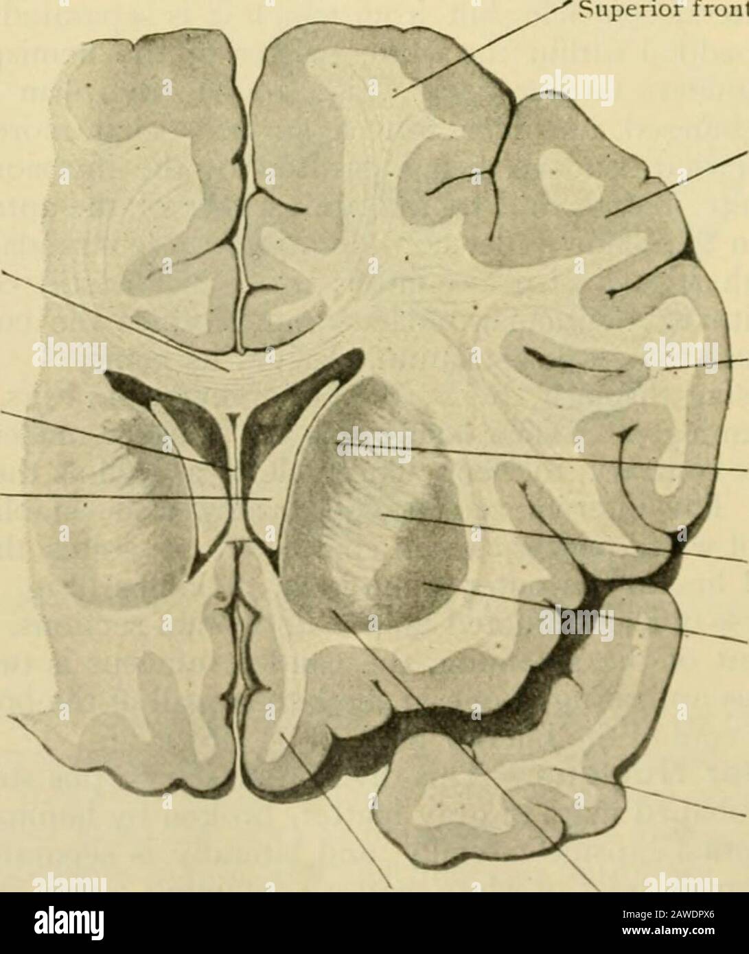 Anatomie des Menschen, einschließlich Struktur und Entwicklung und praktische Überlegungen. I Schwanz des Caudat-Zellkerns Lenticularcleus Rekonstruktion von Corpus striatum und thala-Nius; Seitenaspekt; Sonde liegt in s  )ACE Insassiedby interne Kapsel. Gezeichnet vom Steger-Modell. Fic;. 1009. Superior frontal g&gt;Ües Corpus callosuni Septum luciduin Rechts lateral ventricle.anterior Horn. Mittlerer frontaler GArus Inferiores frontales Gyrus Caudate cleus interne Kapsel Lenticular cleus Temp)orales Lol&gt;e Stetigkeit von Caudate- und linsenförmigen Kernen frontaler Gehirnabschnitt, der durch das vordere Ende des Corpus verläuft Stockfoto