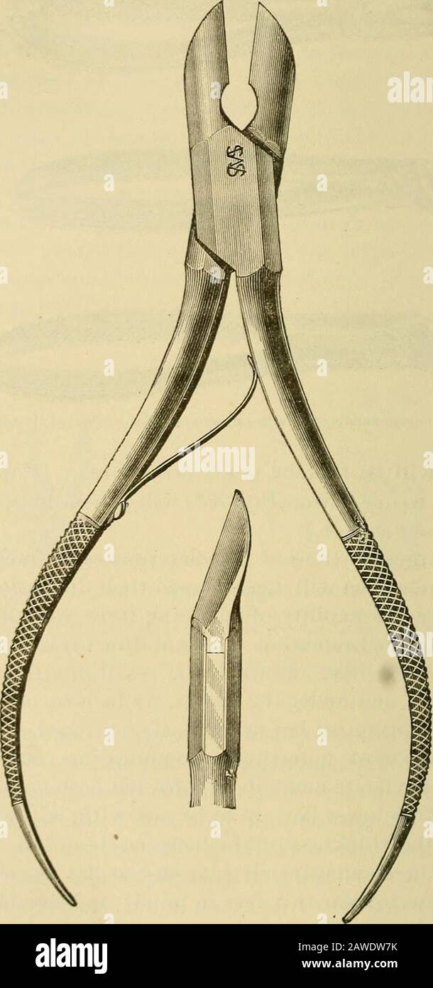 Handbuch der Zahnchirurgie und Pathologie. Zu ihrer Retention zurückgestellt. Fälle direkter Quersplitterung des Unterkiefers sind aufgetreten, das Ergebnis des Versuchs, einen Zahn neu zu bewegen; und unter den Händen, glauben wir, von dieser Whoseskillfulness, da Operatoren nie in Frage gestellt wurden. Wir können diese unglücklichste Komplikation, die auftritt, entkräften, wenn nur eine sehr mäßige Krafteinwirkung eingesetzt wurde: Vorparationen des Unterkiefers sind zu treffen, bei denen mehr als die Hälfte der Knochendicke durch Alveolarabszess verloren gegangen ist. Wo es zu einem extensiven alveolaren Abszess gekommen ist, wird es w sein Stockfoto