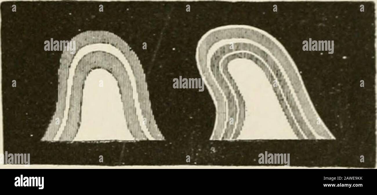 Die Anatomie des Nervensystems, vom Standpunkt der Entwicklung und Funktion und im Septum pellucidum. Die Majorität der Fasern gelangt jedoch in das Mesenzephalon und endet offenbar im interstitiellen Kern. Die Striae longinales. Fornix longus. Und die Fasertrakturen, die in Thesubstallosal Cortex und Septum pellucidum gefunden wurden, waren offenbar Gegenstand einer Fehlinterpretation des Tomuchs; aber das Thema ist zu umfangreich, um hier in Betracht gezogen zu werden.(Siehe Cajal, Histologic du Systeme Xerveux. Bd. II S. 783-823.) Die perforierte Substanz oder zumindest ihr rostraler Teil, die entsprechen Stockfoto