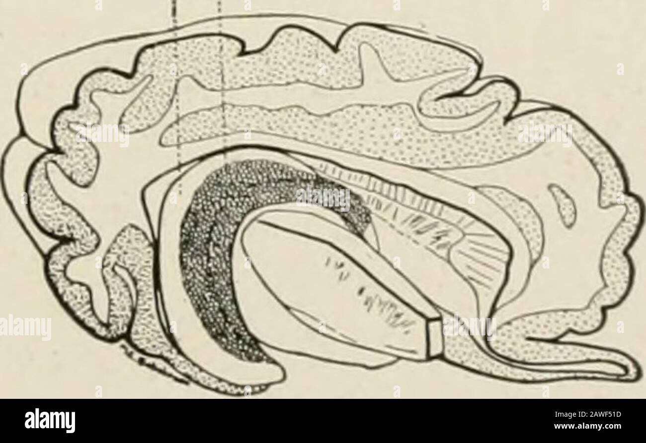 Die Anatomie des Nervensystems, vom Standpunkt der Entwicklung und Funktion. Interventrii ular Foramen Hippocampus /Fimbria of hippocampus Body of Fornix Optic Tract 1 Internal Capsel / f   Olfactory Bulb I! I Rhinoccsle &gt; Genu des Corpus callosum I Körper des Corpus callosumSectum pcllucidum Fig. 182.-Dissektion der Gehirnhemisphäre der Schafe, um den lateralen Ventrikel zu zeigen. Seitenansicht. Fissure wird durch eine künstliche Spalte angezeigt, die sich in den Ventrikel erstreckt, der an den interventrikulären Foramen abträgt und dem Fornix und Fimbria in einem bogenförmigen Verlauf in den Tempor folgt Stockfoto