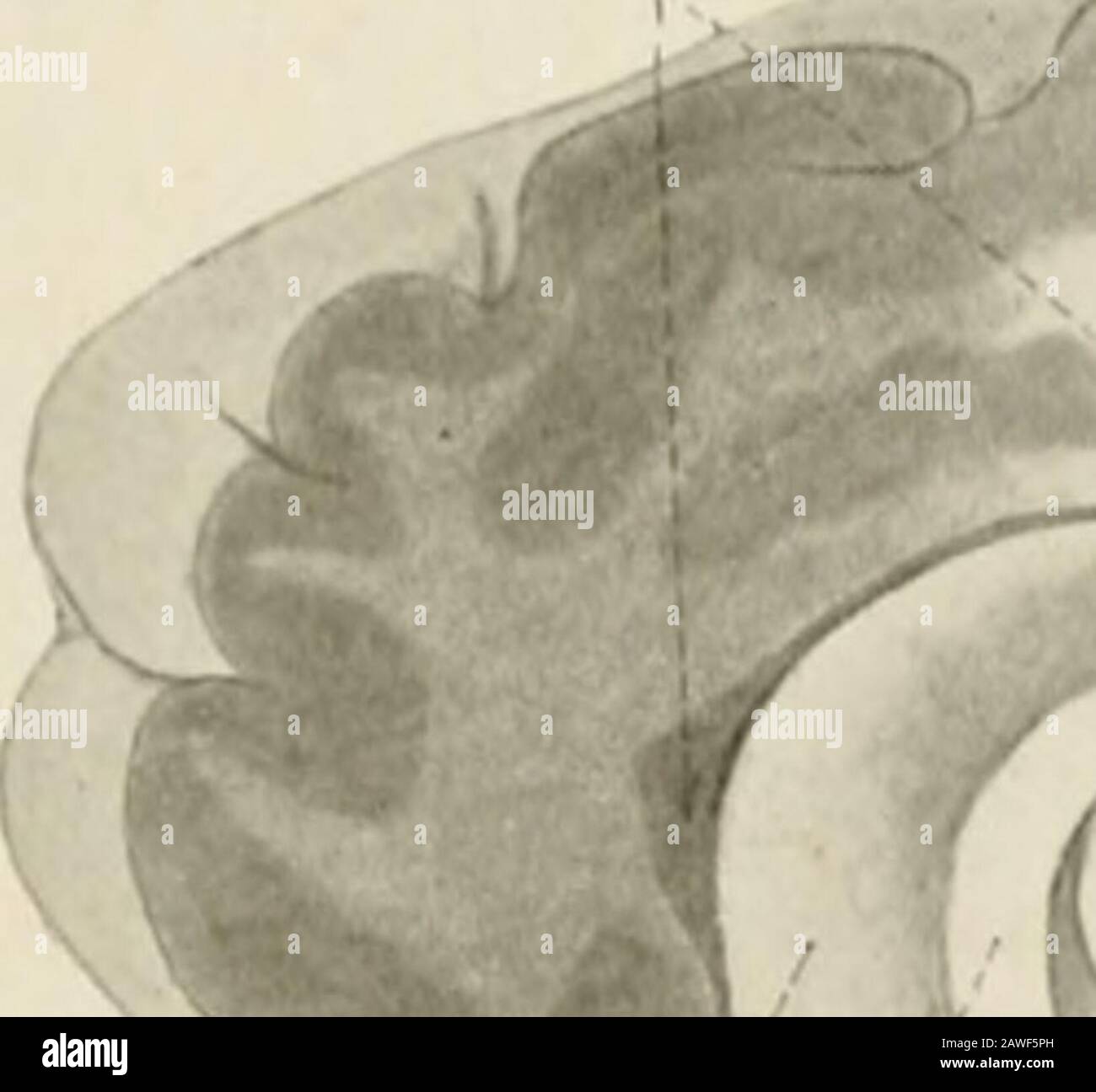Die Anatomie des Nervensystems, vom Standpunkt der Entwicklung und Funktion. Chorioidea des dritten Ventrikels. Ein Geräusch wurde durch die interventrikuläre Foramina geleitet. Dorsale Ansicht. (Sobotta-Mc-Murrich.) im Zusammenhang mit dem Rhinenzephalon gekritzelt. Die herausragende Sicherheit ist die Anhebung im seitlichen Teil des Bodens, der von der Kollateralfissur hergestellt wird. Die dünne Epithelmembran, oben beschrieben als Verbinden des Randes von Thefornix mit dem Caudat-Kern (Abb. 155), diese Strukturen weiterhin vereint, wenn sie beide nach unten, die ehemalige im Boden, die letztere im Dach, Stockfoto