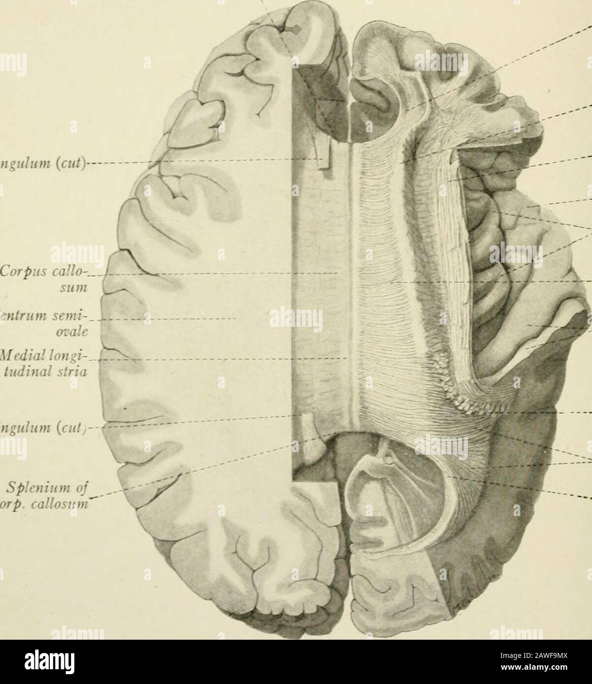 Die Anatomie des Nervensystems, vom Standpunkt der Entwicklung und der Funktion . d von einem schmalen spaltenartigen Raum, dem Cavum septipellucidi (Abb. 177). Wenn das Septum weggerissen wurde, kann es in den lateralen Ventrikel tolook werden und sehen, dass der Corpus callosum den Dachbereich eines großen Teils dieser Höhle bildet. An seiner rostralen Extremität kurvt er abrupt die Hirnbasis, bildet das Genu und verjüngt sich dann schnell zu Therostrum. Letztere ist im Querschnitt dreikantig, mit ihrem Rand nach vorne gerichtet, mit dem sie durch die Rostral-Lamina verbunden ist. T Stockfoto