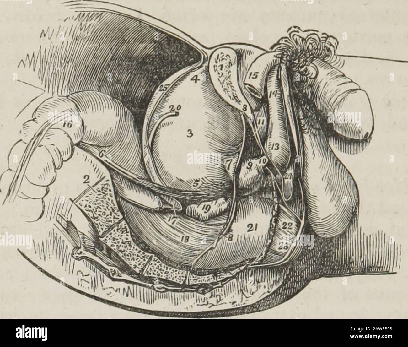 Ein System der menschlichen Anatomie, allgemein und speziell . der Blase zu den inneren Bauchringen, und die zwei posteriorwith den Verlauf der Nabelarterien, zum Fundus des Organs. Die Blase besteht aus drei Mänteln, einem äußeren oder serösen Mantel, einem muskulösen und einem Schleimmantel. Das seröse Fell ist partiell und stammt aus dem Peritoneum, das die hintere Oberfläche und die Seiten der Blase anlegt, von etwa gegenüber dem Endpunkt der Twoureter auf seinen Gipfel, wo es durch die Nabelbänder und den Urachus zur vorderen Wand des Abdomens geführt wird. Der muskulöse Mantel Stockfoto
