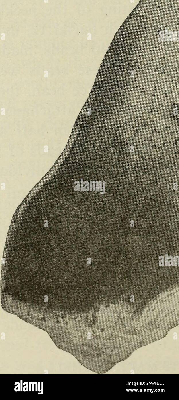 Ohio archäologische und historische vierteljährliche . Abb. 80. Der große Schalenbehälter: Da die Bestattung ein Becken unter dem Boden des Mounds bewohnte, hatten die daraus resultierenden Feuchtigkeitsansammlungen zu einer Verschlechterung der Schalenflecken geführt, und nur wenige wurden vollständig entfernt. Eine der Explorationen der Mound City Group 559 größere davon wurde mit dem Conventionalizedhead eines Vogels eingraviert, während mehrere andere gekonnt exe-becutete konventionelle Designs trugen. Neben den Schellenkorgets gab es in den verschiedenen Mounds der Gruppenornamente aus Oliven und anderen Schalen, By Stockfoto