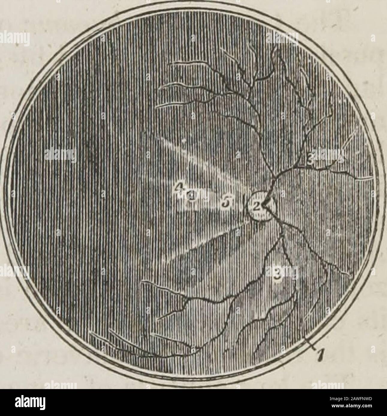 Ein System der menschlichen Anatomie, allgemein und speziell . schöne und genaue Platten, die seine Arbeiten begleiten. Das Konto De Foramine Centrali Retina? Humana?, Limbo Luteo cincto, wurde im Jahr 1779 in der Commentationes Soc veröffentlicht. Reg. Scient.Gottingensis. . . t John Gottfried Zinn, Professor für Anatomie in Gottingen; seine Descnptio AnatomicaOculi Humani, wurde im Jahre 1755-1 mit hervorragenden Platten veröffentlicht. Es wurde von Wrisberg im Jahr 1780 neu herausgegeben. ", ,  , t Das hintere Segment eines Querschnitts des Augenglobus, gesehen von frominrot. 1. Der geteilte Rand der drei Tunika. Die Membranabdeckung Stockfoto