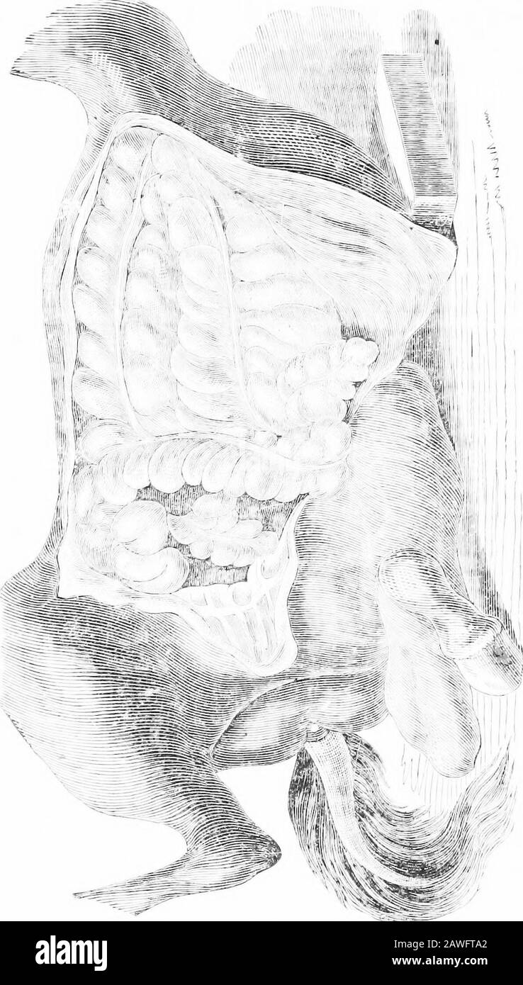 Das amerikanische Buch reformierter Pferde, eine Abhandlung über die Ursachen, Symptome und Heilung aller Krankheiten des Pferdes, einschließlich jeder für Amerika besonderen Krankheit, auch Zucht, Aufzuchten und Behandlung . und wenn Fäkalien ausscheiden, bestehen sie aus kleinen, gehärteten Kugeln. Eine Untersuchung nach dem Tod enthüllt einen gangösen Zustand des Einkaufszentrums und manchmal der großen Eingeweide. Oft findet man Extravasatedtlood innerhalb des Darmrohrs. Sobald die Schmerzen aufhören und das Tier nicht besser erscheint, führen wir aus, dass sich die Gangrenehas einsetzten; kalte Schwitze setzen ein, und das Tier stirbt in Kürze. Behandlung: Die Behandlung von Stockfoto