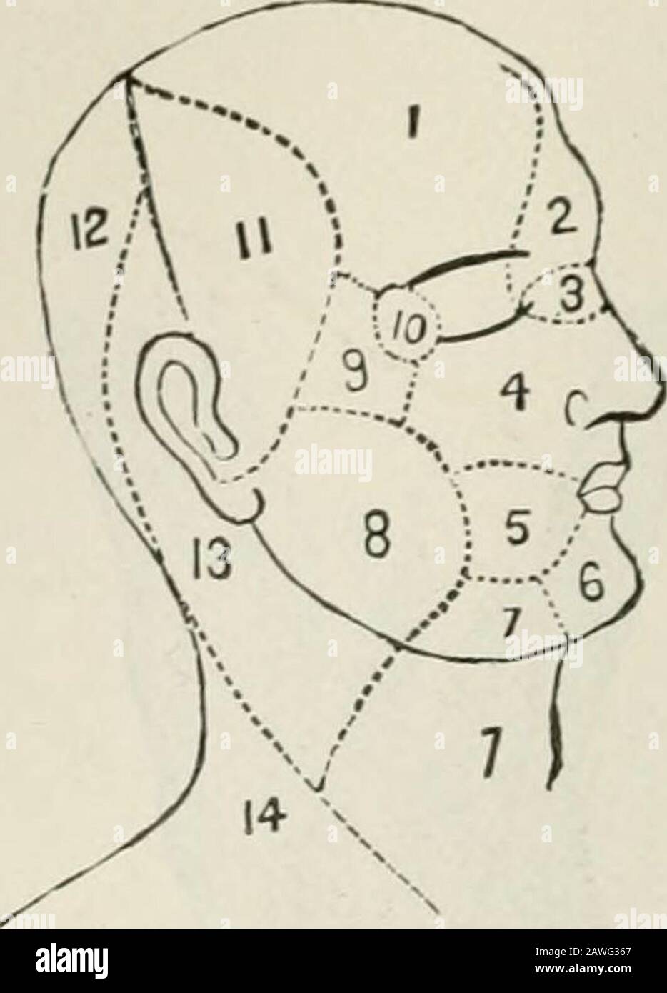 Vorträge über Nervenkrankheiten aus Sicht der Gehirnlokalisierung und Spinallokalisierung sowie über die späteren Methoden, die bei der Diagnose und Behandlung dieser Affektionen eingesetzt werden. TiiK Motor Zeigt auf den Uutek-Aspekt ok das Bein.1, peronaler Nerv; 2, externer Kopf des Musculus gastrocnemius; 3, Musculus soleus; 4. Musculus extensor communis digitorum; 5, Musculus peroneus brevis; 0, Musculus soleus;7, tkxor longis pollicis; 8, Musculus perus loneus loneus; Musculus loneus; Musculus; Es, tibialis anticus mus(;le; 10,extensor longus pollicis muscle: 11, extensor brevis digitorum muscle: 12. Ab-Ductor minimi digiti muscle; l.>, tiefes Bran Stockfoto