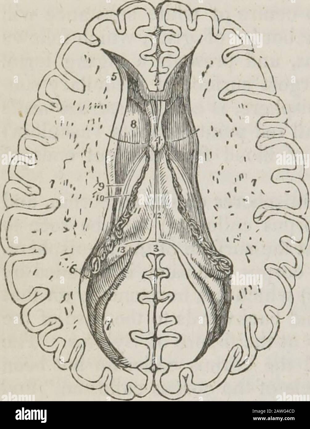 Ein System der menschlichen Anatomie, allgemein und speziell . r nach vorne als zum pos-terior Teil des Gehirns und endet anteriorly an einem abgerundeten Rand(Genu), der nach unten zur Basis des Gehirns, vor der Sicherheit der Sehnerven, verfolgt werden kann. Posteriorly bildet sie athick gerundete Falte (Splenium), die beim Fornix durchgehend ist.Die Breite des Corpus callosum beträgt etwa vier Zoll. Unter dem hinteren abgerundeten Rand des Corpus callosum befindet sich die thretransverse Fissure des Großhirns, die sich zwischen den Hemisphären und dem Crura cerebri von ganz in der Nähe der Fissure von erstreckt Stockfoto