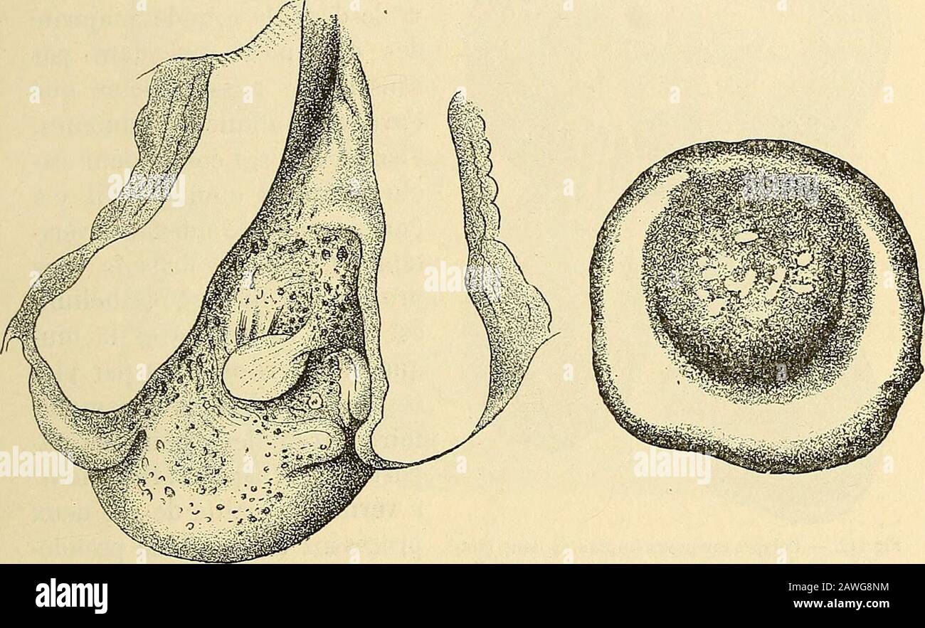 TraitÃ© de gynÃ©cologie clinique et OpÃ©ratoire . Ã©lier. ConsidÃ©rations jyratiques sur le traitement des maladies de la matrice (MÃ©-moires de lAcadÃ©mie de mÃ©d., 1853, t. II, S. 550). 3 Tyler Smith. MED. Chir. Transact., 1852, XXXV, S. 598. 4 Roser. BAS Ectropiumam Mullermund (Arch. Der Ileilkundc, 1881, II, S. 97). ANATOMIE PATHOLOGIQUE ET ÃTIOLOGIE DES MÃTR1TES. 159 inenteux, il sy produit des glandes juxtaposÃ©es, et la substance inter-glandulaire pränd entres ces dÃ©pressions laspekt des pieux dunepalissade, doÃ¹ laspect papillaire de la surface. Lorsquune dÃ©chi-rure bilatÃ©rale du col Stockfoto