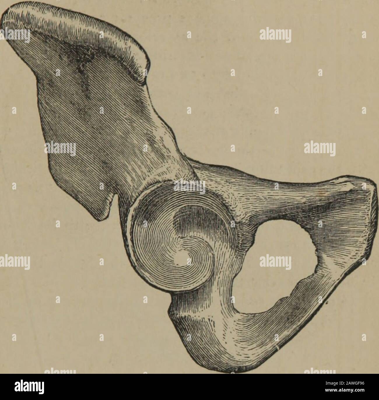 Die Prinzipien und die Praxis der Geburtshilfe. Sie wird als Iliakusfossa oder venter bezeichnet und wird vom Musculus iliacus mterrais besetzt. Diese Oberfläche wird vom unteren Teil des Knochens durch die Linea-ilio-pectinea getrennt, eine Linie, die entlang der Krempe oder der übergeordneten Kontur des Beckens verläuft • itis dieser untere Teil des Iliums, der zur Formung von zwei Fünfteln des Acetabulums beiträgt. Die hintere Oberfläche ist von dem Teil des Iliums unmittelbar hinter der Iliakenfossa vermadeup, der einen groben, unregelmäßigen Aspekt darstellt, von dem es zwei Unterteilungen gibt, eine überragende, die andere unterlegen. Stockfoto