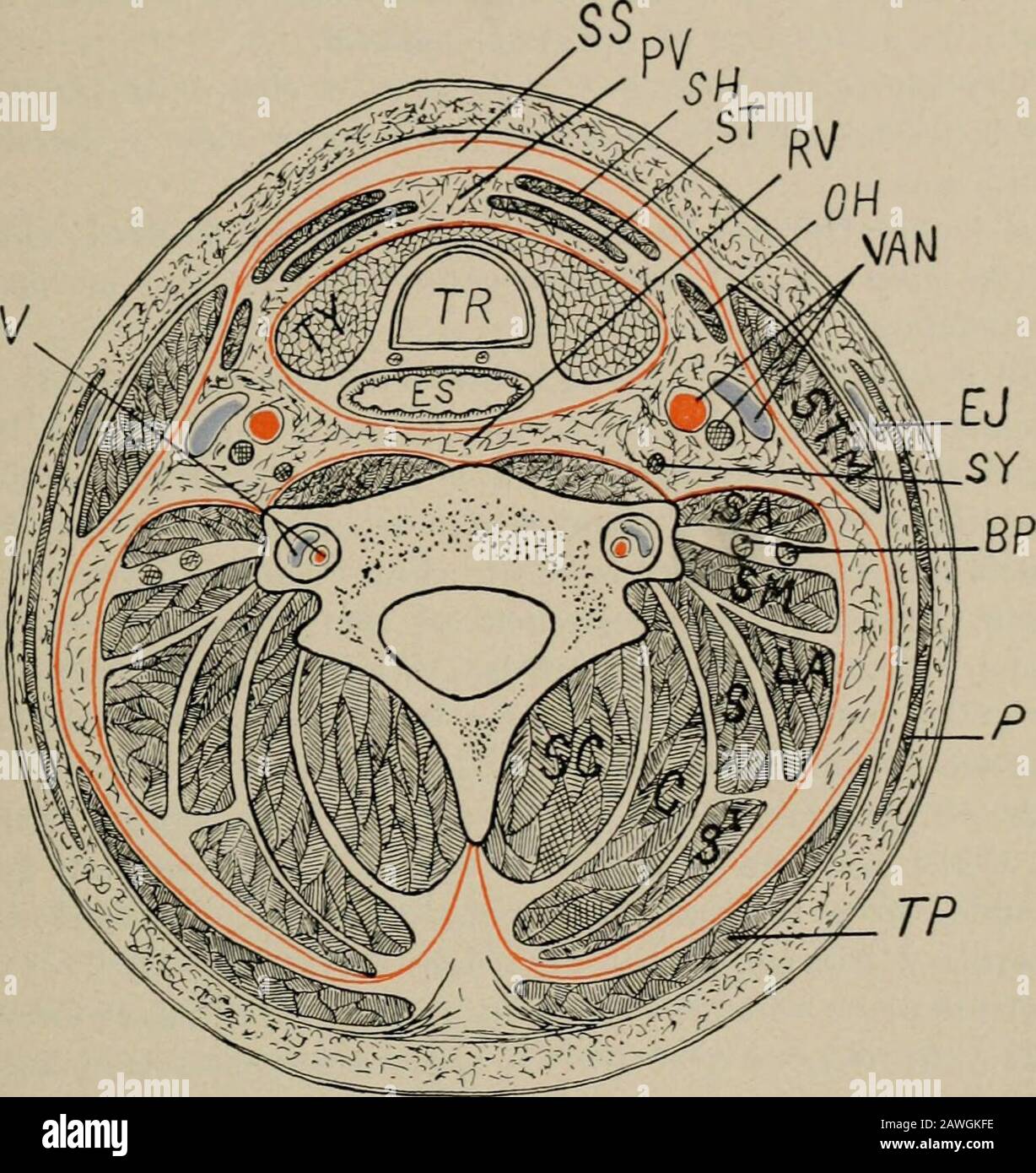 Operative Chirurgie, für Studenten und Praktizierende . oder Grenze dieses Muskels rückwärts über das poste-rior-Dreieck des Halses und unter dem Musculus trapezius, wo es dient, die langen Muskeln des Halses an die Wirbelsäule zu binden. Oben ist die tiefe Halsfaszie an der unteren Kiefergrenze und am hinteren Teil des Schädels befestigt, darunter an der oberen Grenze des Brustbeins, am Schlüsselbein, an der Wirbelsäule des Scapula und an dem abscheulichen Prozess des siebten Halswirbels: Wirbel prom-inens. In der mittleren Linie des Halses, dahinter, wird die tiefe Cervicalfascia mit dem Ligamen gemischt Stockfoto