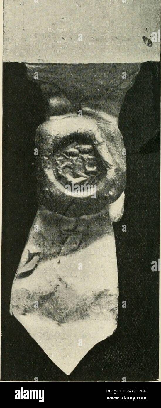 William Shakespeare, Spieler, Spielmacher und Dichter; eine Antwort auf MrGeorge Greenwood, M.P . egible orilliterate. Der Appell kann nur das Augenmaß von Personen sein, die daran gewöhnt sind, die Ourolder-Hände zu lesen. Aber es ist möglich, Aufmerksamkeit auf Tocertain Details zu lenken, die dem beiläufigen Beobachter entkommen können,(i) Die beiden Unterschriften in zwei verschiedenen Skripten stehen; kein Analphabet würde zwei Hände schreiben, aber Play-wrights tat dies gewöhnlich, um den Text von den Bühnenanweisungen zu unterscheiden - Eine Tatsache, dass jeder, der das Manuskript lesen kann, im BritishMuseum spielt. (2) Die Unterschriften sind die von A. Stockfoto