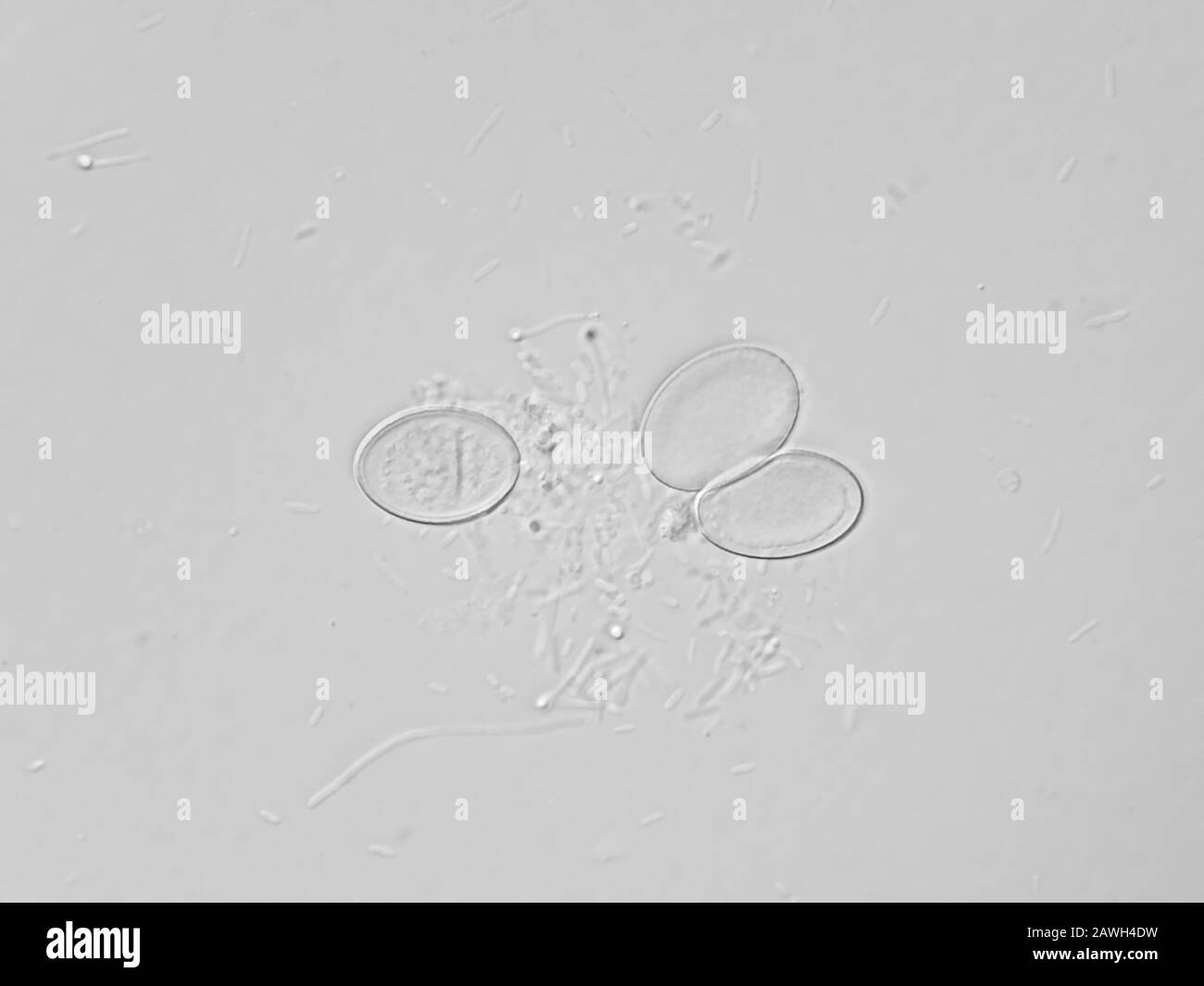 Schmutzwasser unter dem Mikroskop - viele lange stabförmige Bakterien und drei Pilzascosporen Stockfoto