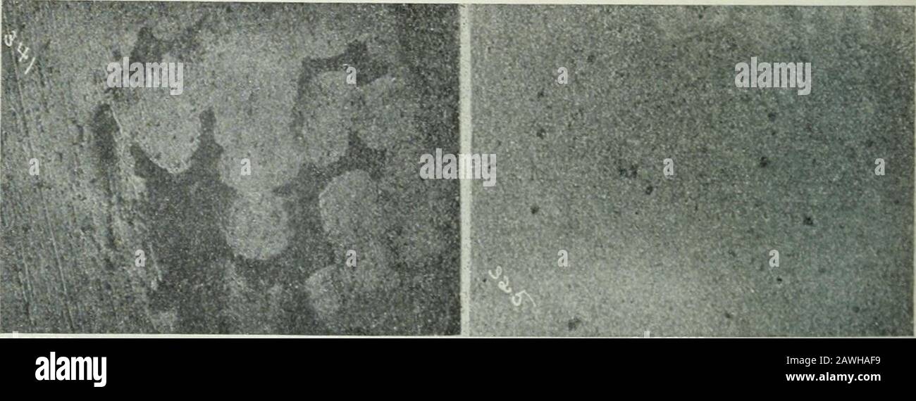 Transaktionen . Abb. 17d.SiO, 0,058 Prozent. Abb. 18.C, 0."7 Prozent. ;O, 0,038, 0,037 Prozent. Abb. 19.C, 0,06 Prozent.O, 0,028, 0,029 Prozent.SiO, 0,052 Prozent.Platte V.-Proben von Heats G und H. Abb. 20.C, 0,04 Prozent.O, 0,033 Prozent. Alle Abschnitte Vergrößerten 140 Durchmesser - ÜBEROXIDATION VON STAHL. 447 Hitze H: -47.000 lb. Metall wurden weich geblasen und Test 18 verschwenden. Eine Analyse zu Test 18 ergab: C, 0,07 Prozent; O, 0,038 und 0,037 Prozent. As.in Heat G, 1.000 lb Erz wurden dem Schiff hinzugefügt, aud Test19 wurde zwei Minuten später genommen. Test 19 analysiert: C, 0,06 Prozent; O, Stockfoto