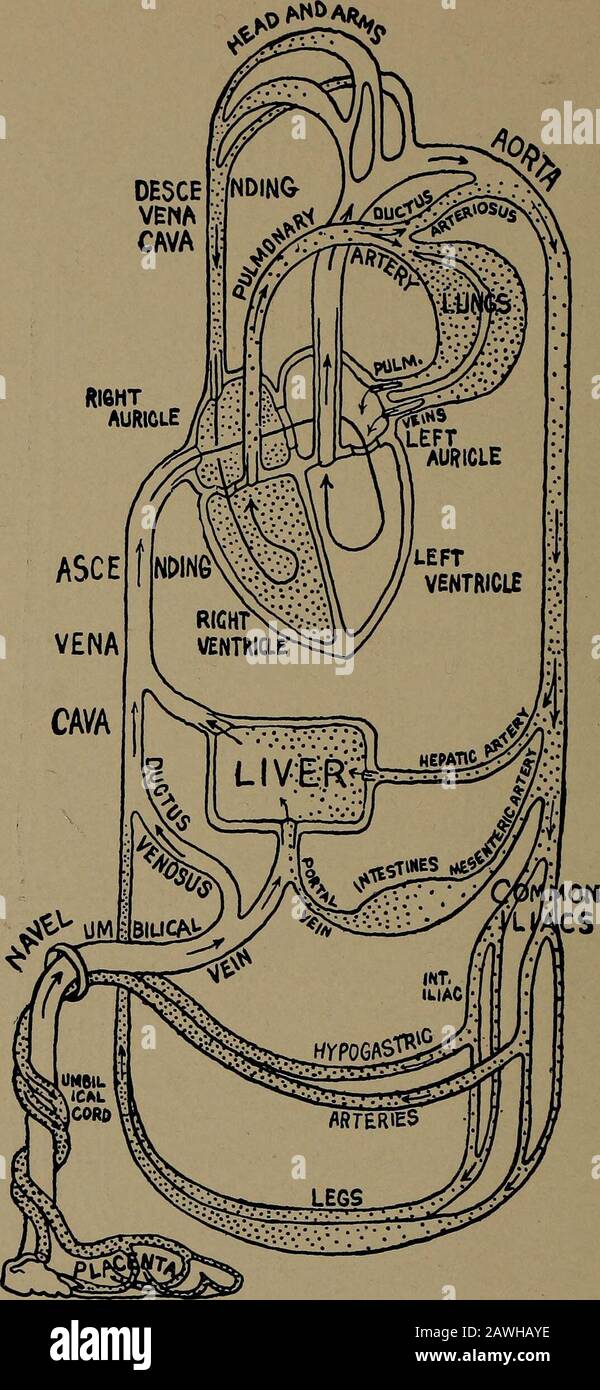 Ein Handbuch der Krankenschwester für die Geburtshilfe, für den Einsatz in Schulen. I 1 ARTERIELLES BLUT FC&M VENOU5 BLUT ABB. 28.-Diagramm der Zirkulation nach der Geburt. Erwachsenentyp. 58 EIN KRANKENSCHWESTER-HANDBUCH DER GEBURTSHILFE. ARTERIELLER BLOODHH VENÖS, BLUT ABB. 29.-Diagramm der Zirkulation vor der Geburt. Fetaltyp. FETALE ZIRKULATION. 59 Zeitdauer ist das Foramen ovale, eine ventilähnliche Öffnung zwischen der rechten und linken Aurikel. Die anderen sind der Ductusarteriosus, der die Aorta und die Lungenarterie verbindet; der Theductus venosus, der die Nabelvene und die Aszendingvenenkava verbindet; und die beiden hypogastischen Arterien, Stockfoto