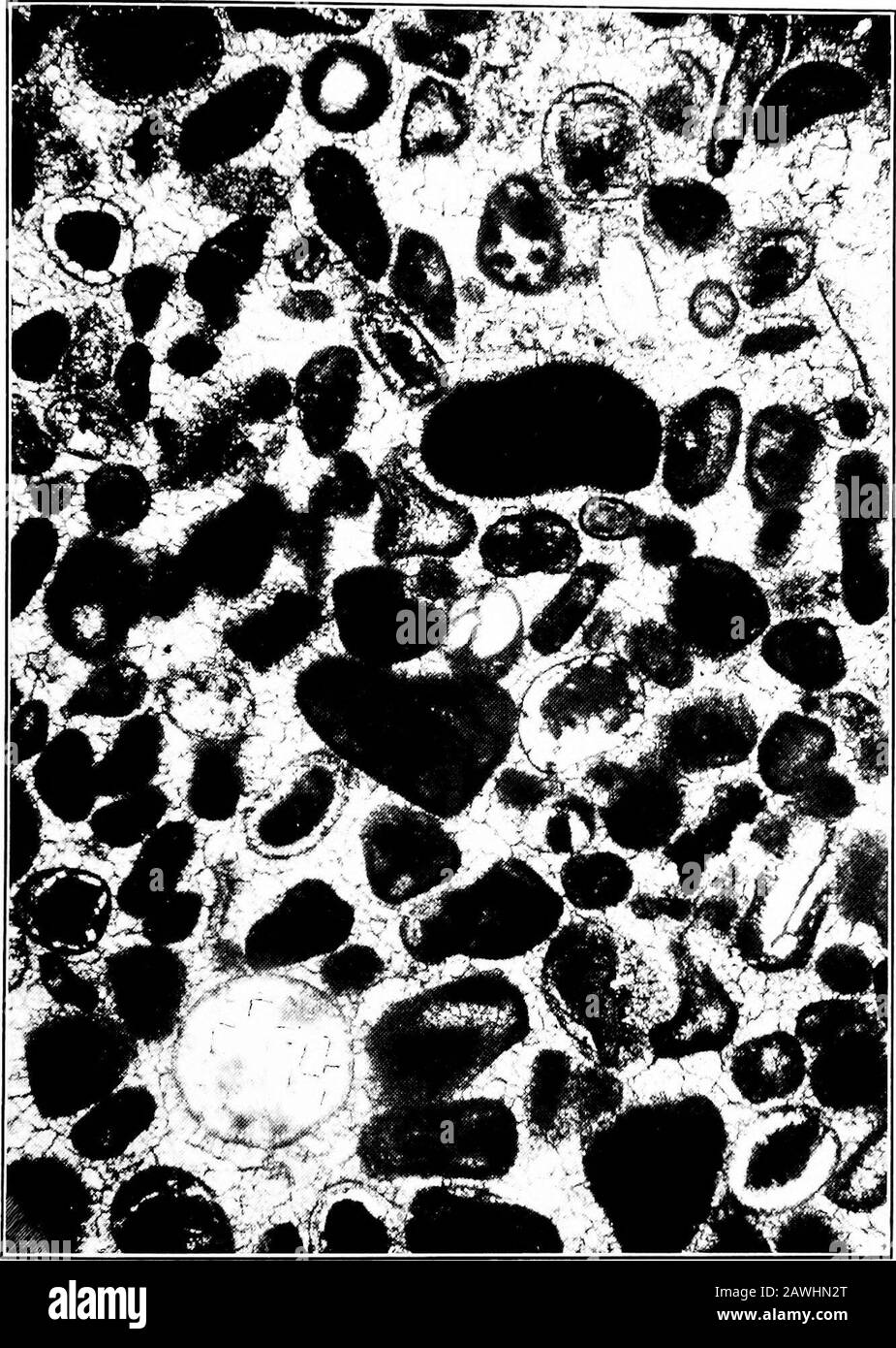 Das tiefe Bohren bei Spur . Platte 5. Vertikaler Abschnitt eines Dolomits,  der die Umrisse zahlreicher organischer Bruchstücke kleiner Größe zeigt,  die in eine Matrix von gröberem kristallinem Dolomit eingebettet sind. Die