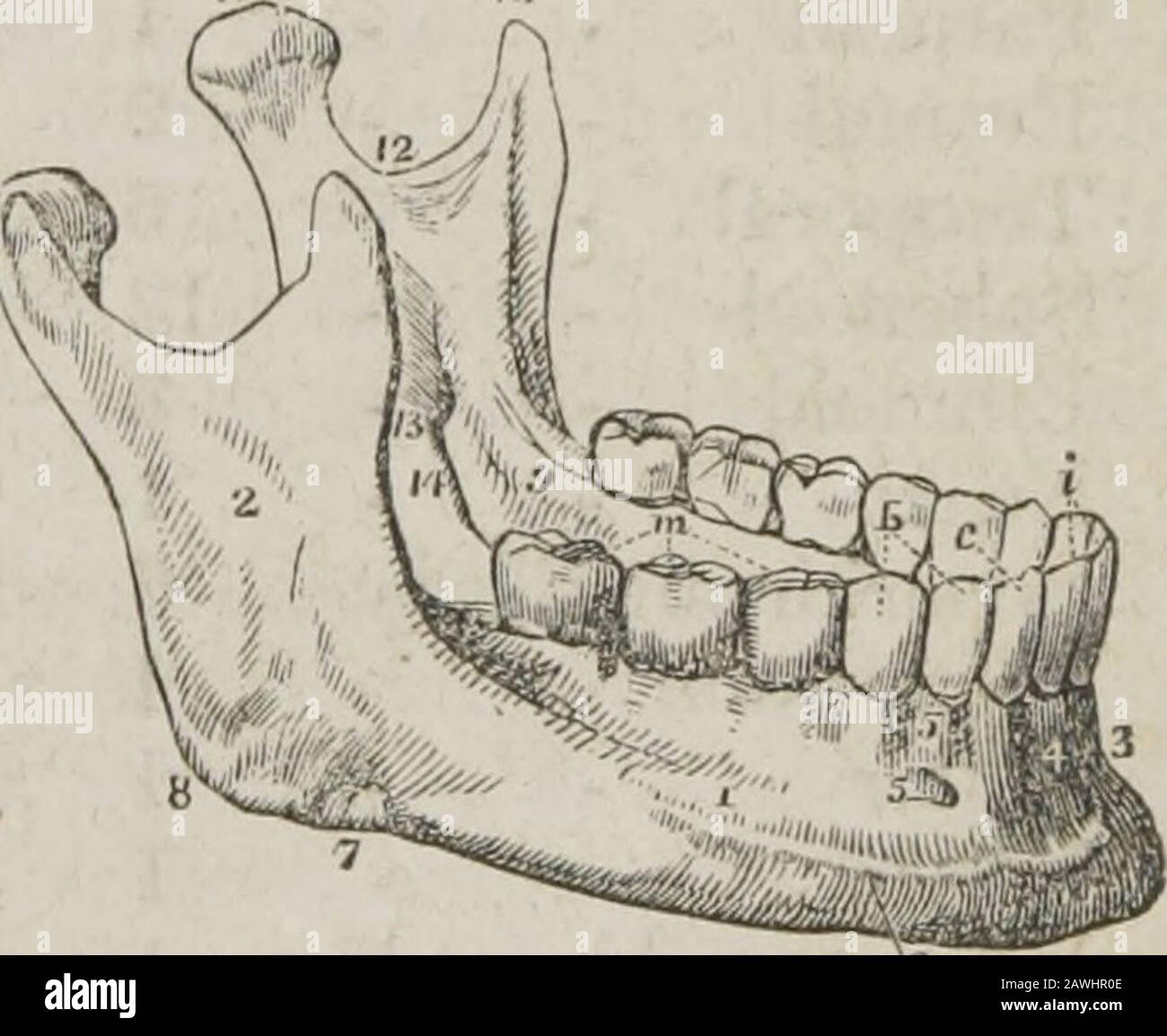 Ein System der menschlichen Anatomie, allgemein und speziell . d des äußeren Pterygoidmuskels. Die sig-moide Kerbe wird von der Arterie und dem Nerv der Masseterie durchzogen. Die innere Oberfläche des Ramus wird in der Nähe seiner Mitte durch Alarge oblique Foramen, das inferiore Dental, für den Eingang der Zahnarterie und des Nervus in den Zahnkanal markiert. Die Begrenzungsöffnung ist ein scharfer Rand, an den der innere laterale * Der Unterkiefer befestigt ist. 1. Der Körper. 2. Der Ramus. 3. Die Symphyse. 4. Der Musculus depressor labii inferioris. 5. Das mentale Foramen. 6. Der externe Ob-lique-Grat. 7. Das gr Stockfoto