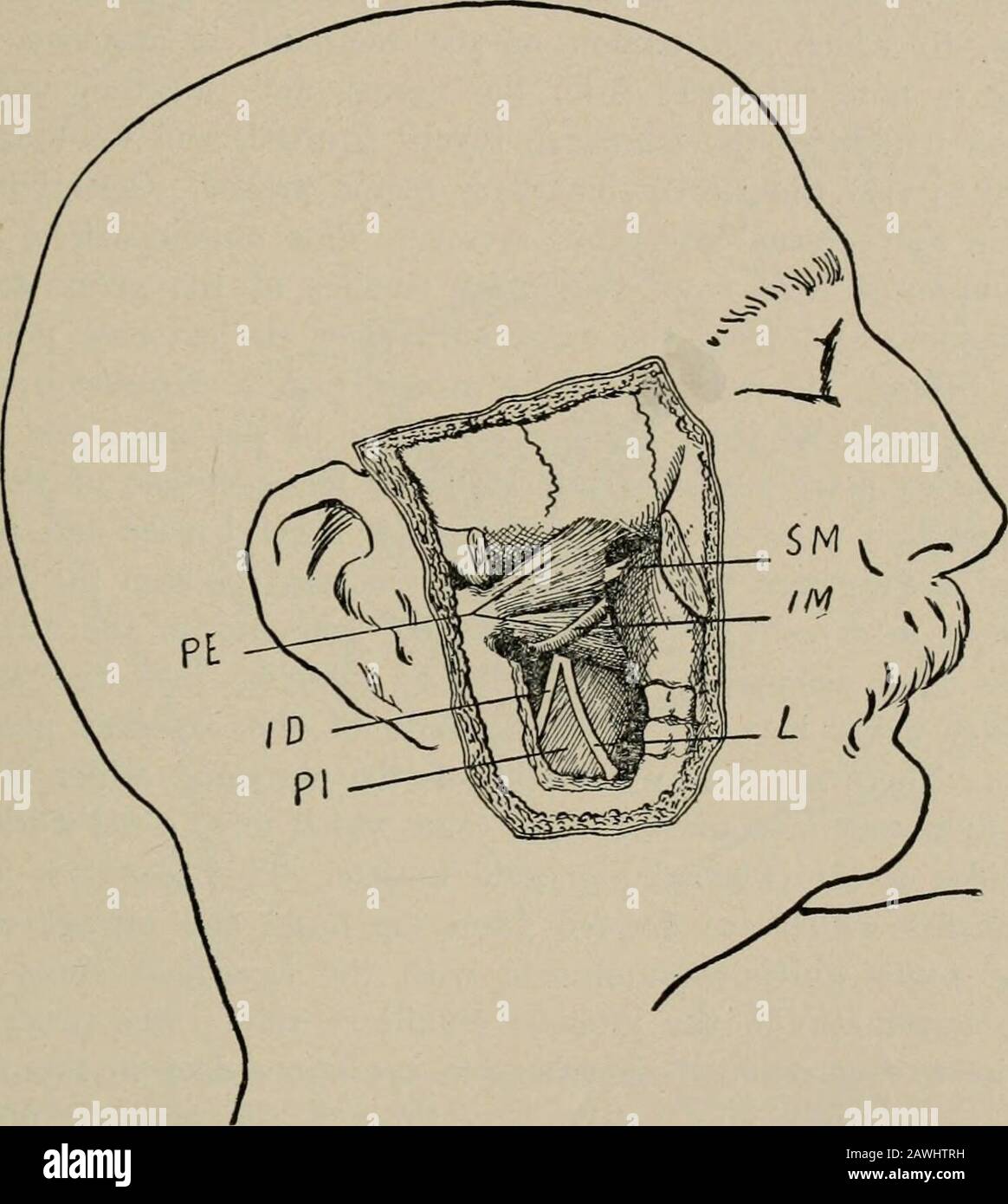 Operative Chirurgie, für Studenten und Praktizierende. Oder Temporo-maxillare Vene vielleicht geteilt. Unter der Parotiddrüse oder innerhalb ihrer Substanz teilt sich die Arteria externalcarotis in ihre terminalen Äste auf: Die innere Maxillararterie und die zeitliche. Das Temporal steigt durch die Drüsenunterlage und über die Wurzel des Zygoms, kurz vor der Ährenunterlage, den hintersten Toit liegenden auriculo-zeitlichen Nerv, und etwa zwei Zentimeter über dem Zygom teilt es sich in den Ante-Rior und das hintere Temporal auf. Diese Äste, die in der Unterseite DES GESICHTS untergebracht sind. I39 Kabelverbindung- Stockfoto