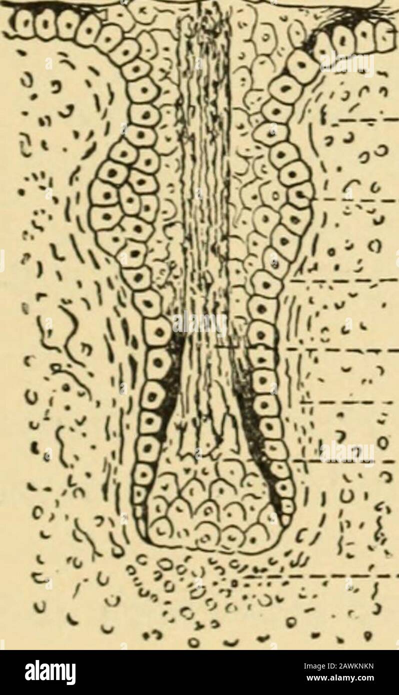 Ein System der Geburtshilfe . C ^^ 55^ ^K0 0 E ¥    ^ >s -;-.--:-PZ--^Y:r-HK (Aus Wiedersheim.) Sechs Stufen bei der Entwicklung eines Haares: Sc, Stratum comeum der Epi-dermis: SM, Stratum Malpighii; C, Dermis; F, Haarfollikel, Haarausfall; Haarausfall; PZ, das Rudiment des Epithels des Haarfollikels; P, Kommencementof Papilla; P, Papille fortschrittlicher und nachdem es zu Gefäßen geworden ist. Stockfoto