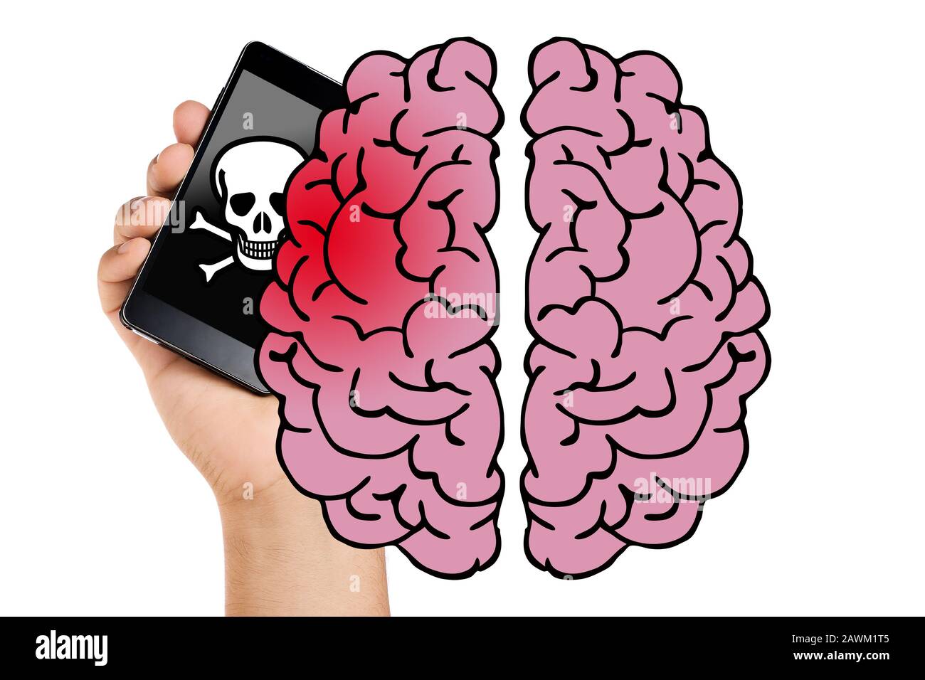 Die Hand hält mobiles strahlendes Gehirn und verursacht Gesundheitsschäden isoliert. Krebskonzept Stockfoto