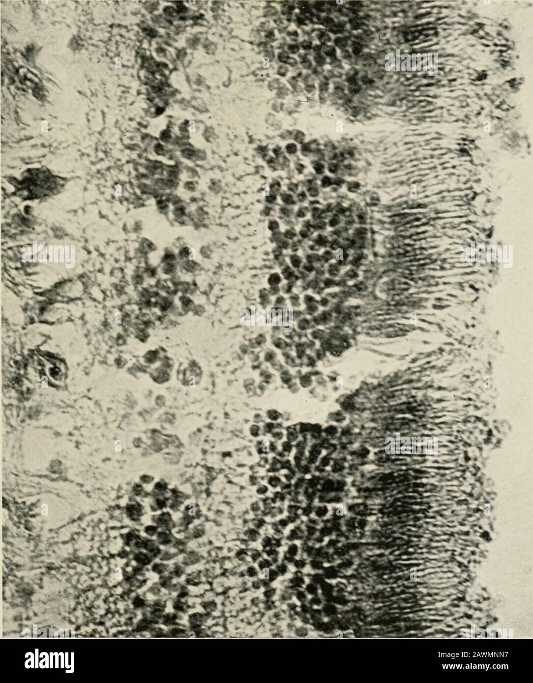 Transaktionen . ABB. IV HLMAX-NETZHAUT. DIE ENDSCHLAUFEN DER KEGEL IN DER MAKULA-REGIONPREPARATION WERDEN DURCH DEN DRUCK DER EINTAUCHLINSE AUF DAS DECKGLAS GEBROCHEN. X c D O K C?J 2 2i c C j: Stockfoto
