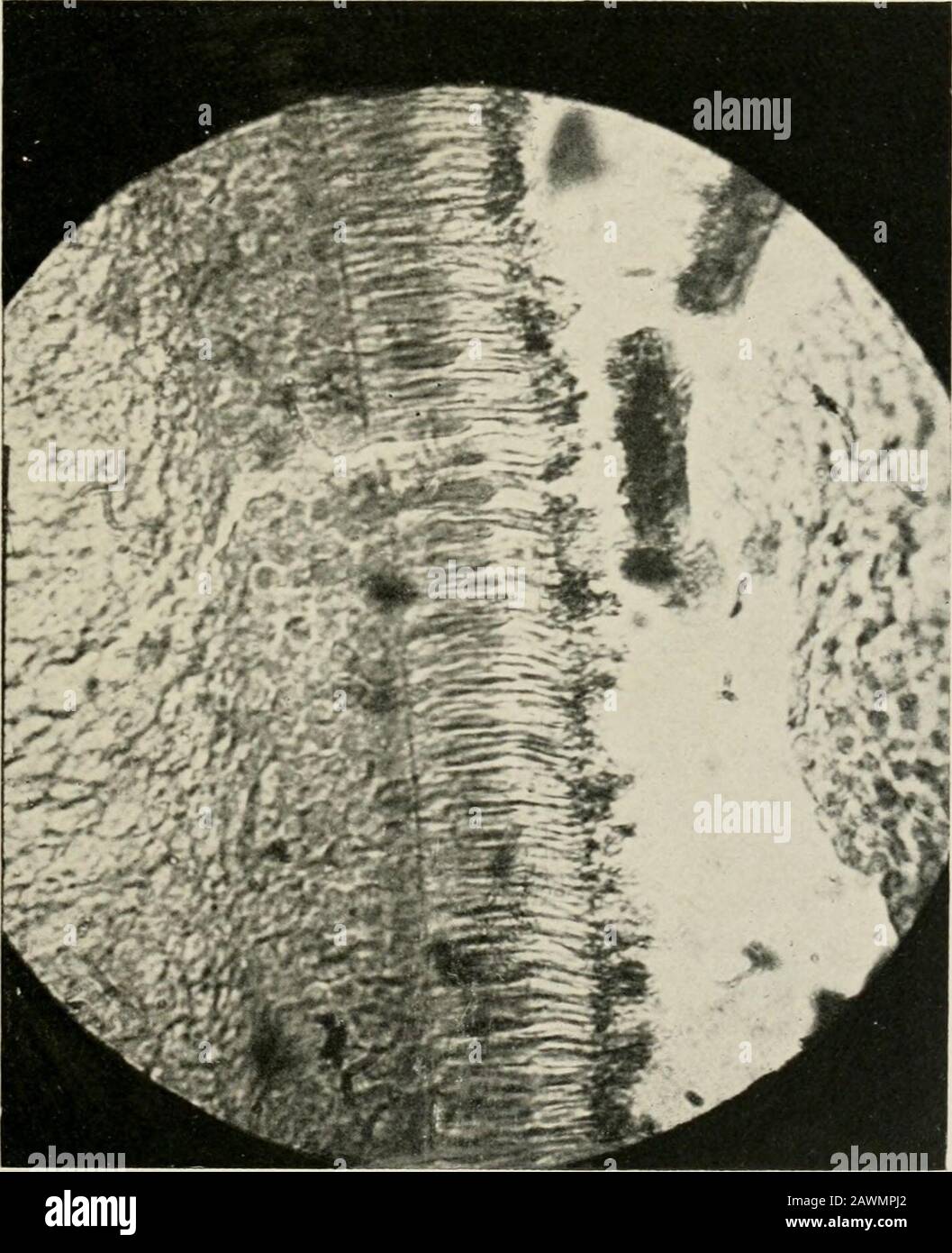 Transaktionen . durch die Sektion gerandet; viele Pigmente haften noch an ihren äußeren Mitgliedern. In der Plazeskann man sehen, dass die Loops über das dichte Pigmentmaterial hinausragen, das sich noch fest am äußeren Teil innerhalb der Position der Loop anhaftet. Der Kern an der Basis jedes Kegels ist wunderschön ausgeprägt. Abb. Ill stellt einen ähnlichen Teil der Netzhaut dar, der weniger magnifiziert ist als Abb. I, aber größer als Abb. II Die Loops, stellenweise, zeigen deutlich. Abb. IV zeigt die geschleiften Extremitäten der Kegel an einem Punkt, an dem die Zubereitung versehentlich durch Voreintauchen der Eintauchlinse auf dem gebrochen wurde Stockfoto