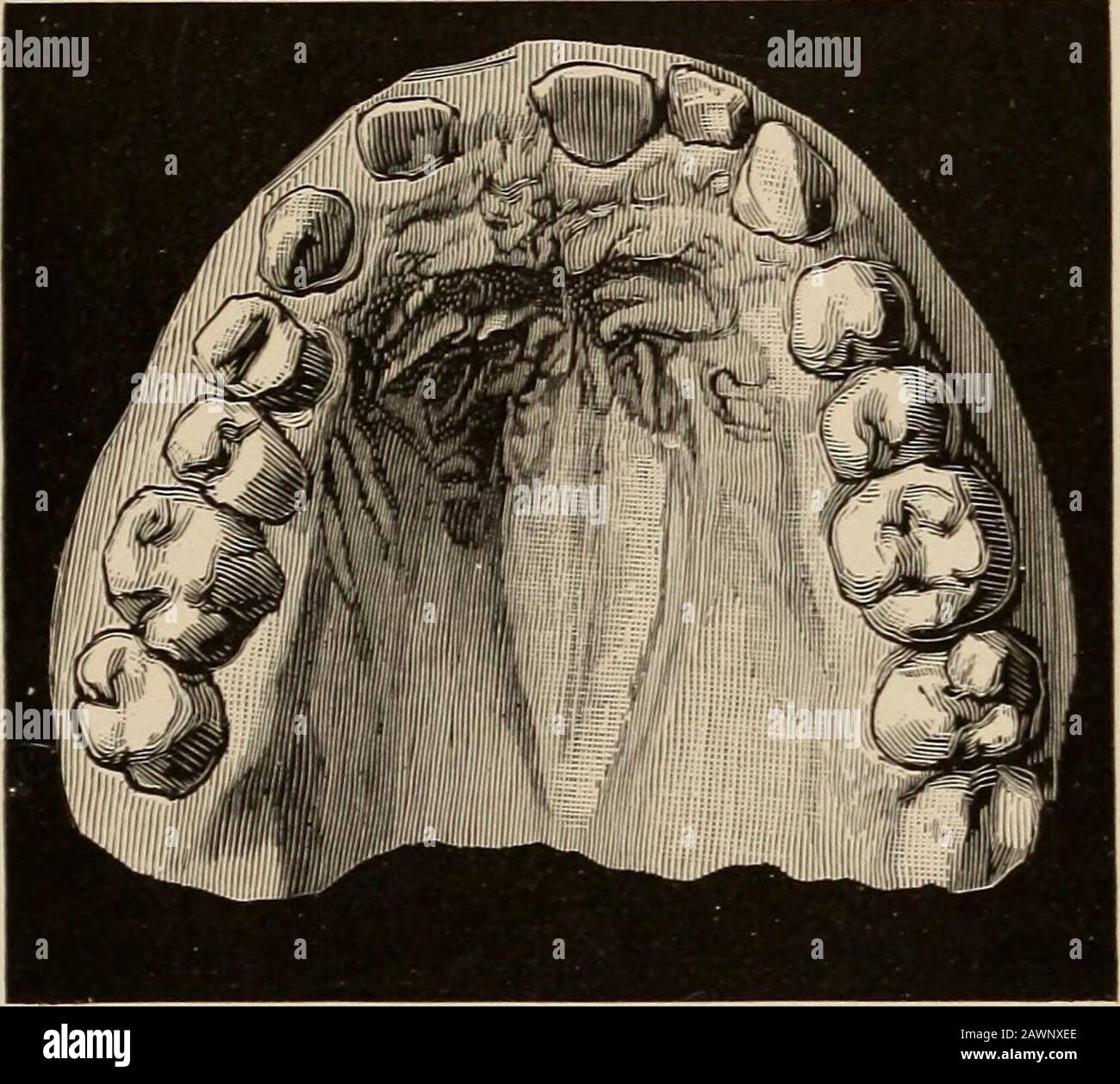 Torus palatinus Fotos und Bildmaterial in hoher Auflösung Alamy