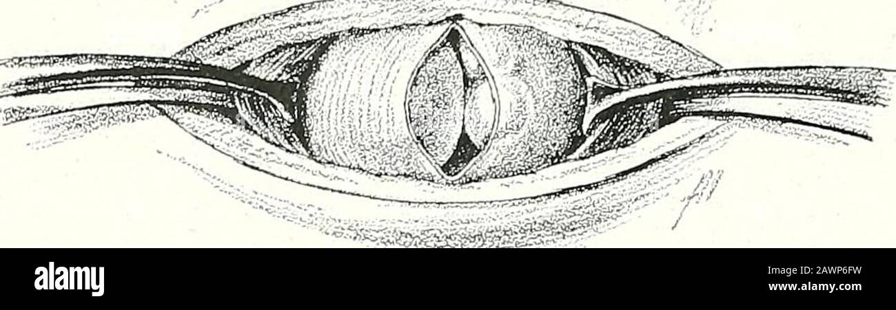 Grande arteria di superficie Fotos und Bildmaterial in hoher